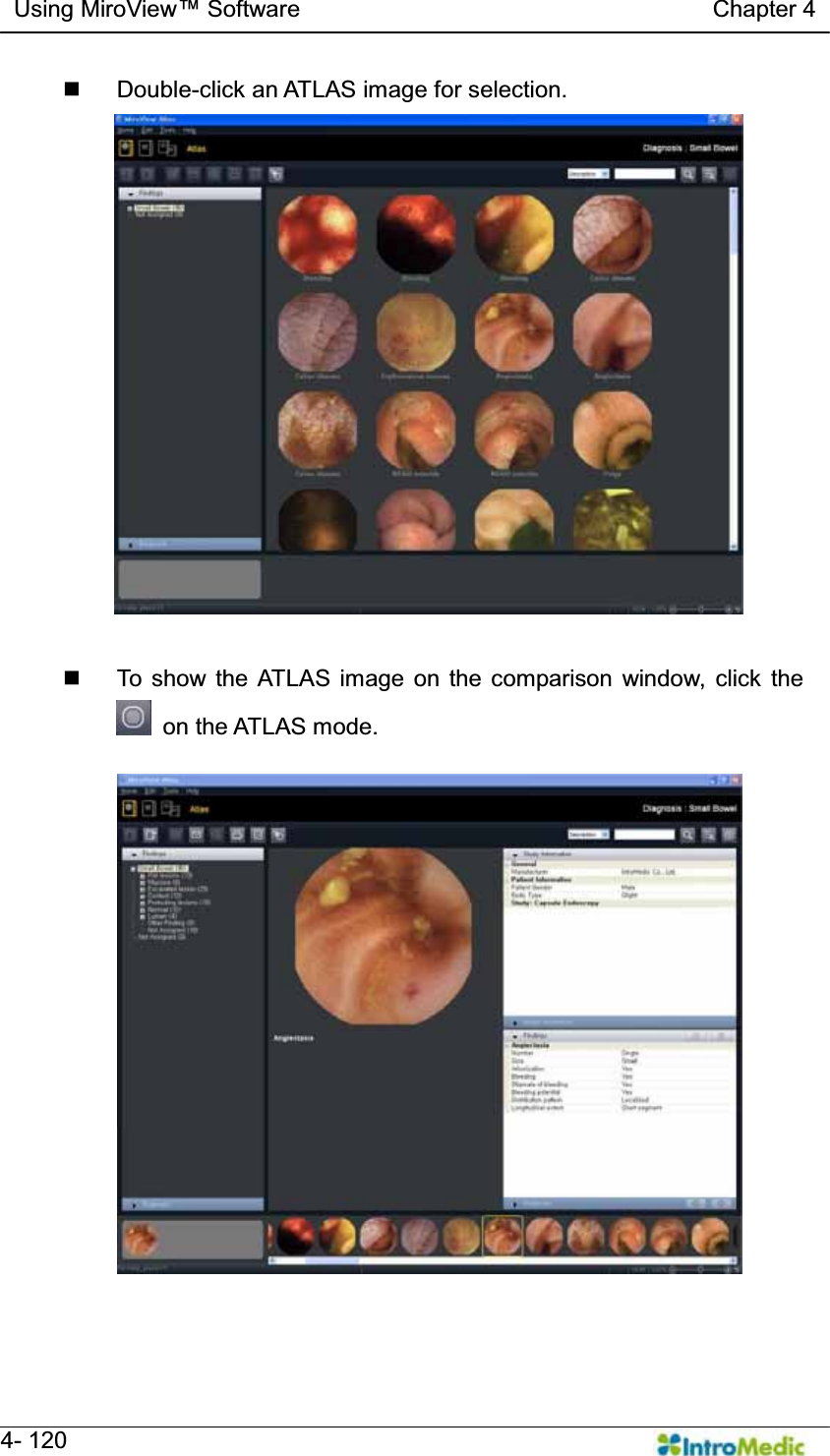   Using MiroView Software                                   Chapter 4   4- 120  Double-click an ATLAS image for selection.    To show the ATLAS image on the comparison window, click the  on the ATLAS mode.  