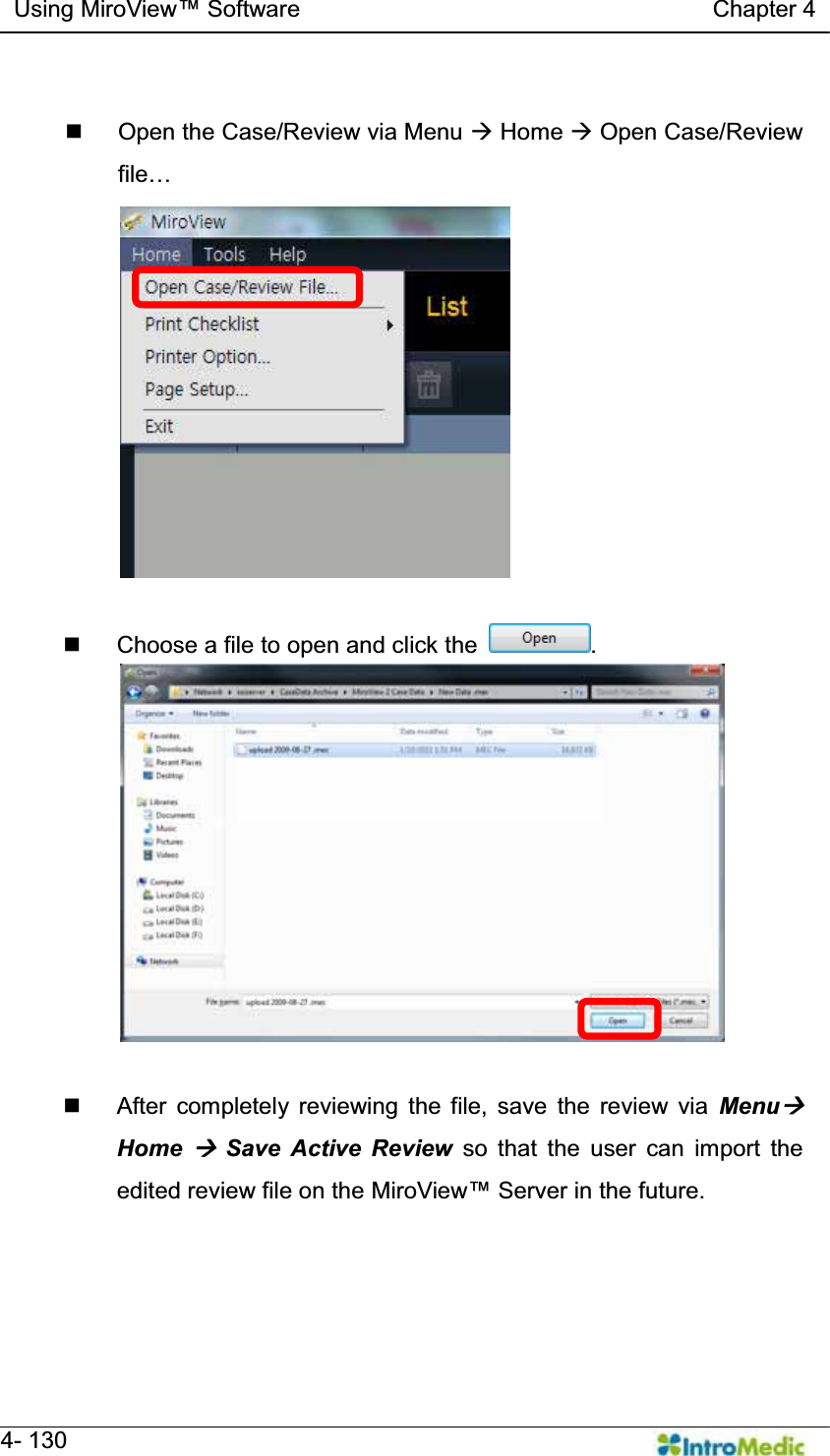   Using MiroView Software                                   Chapter 4   4- 130    Open the Case/Review via Menu Æ Home Æ Open Case/Review ILOH«     Choose a file to open and click the  .    After completely reviewing the file, save the review via MenuÆ Home Æ Save Active Review so that the user can import the edited review file on the 0LUR9LHZServer in the future.    
