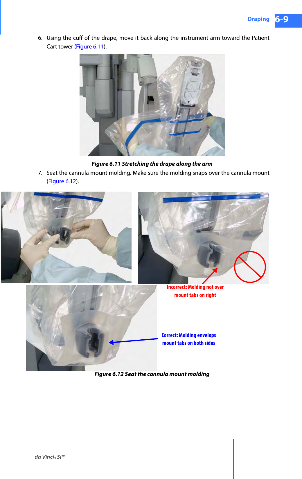 da Vinci® Si™Draping 6-9DRAFT/PRE-RELEASE/CONFIDENTIAL 10/9/146. Using the cuff of the drape, move it back along the instrument arm toward the Patient Cart tower (Figure 6.11).Figure 6.11 Stretching the drape along the arm7. Seat the cannula mount molding. Make sure the molding snaps over the cannula mount (Figure 6.12).Figure 6.12 Seat the cannula mount moldingIncorrect: Molding not overmount tabs on rightCorrect: Molding envelopsmount tabs on both sides