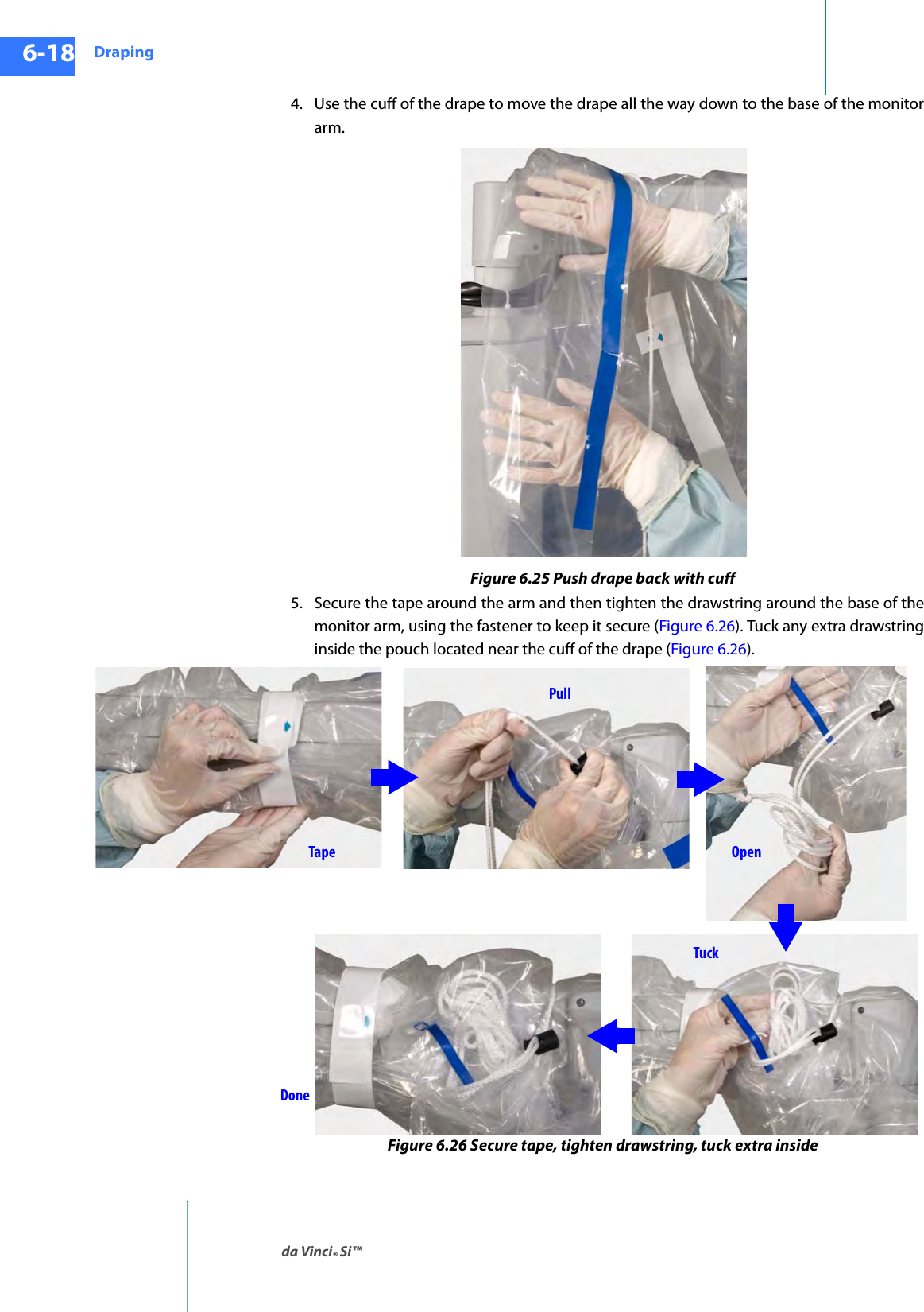Drapingda Vinci® Si™6-18DRAFT/PRE-RELEASE/CONFIDENTIAL10/9/144. Use the cuff of the drape to move the drape all the way down to the base of the monitor arm.Figure 6.25 Push drape back with cuff5. Secure the tape around the arm and then tighten the drawstring around the base of the monitor arm, using the fastener to keep it secure (Figure 6.26). Tuck any extra drawstring inside the pouch located near the cuff of the drape (Figure 6.26).Figure 6.26 Secure tape, tighten drawstring, tuck extra insidePullOpenTuckDoneTape