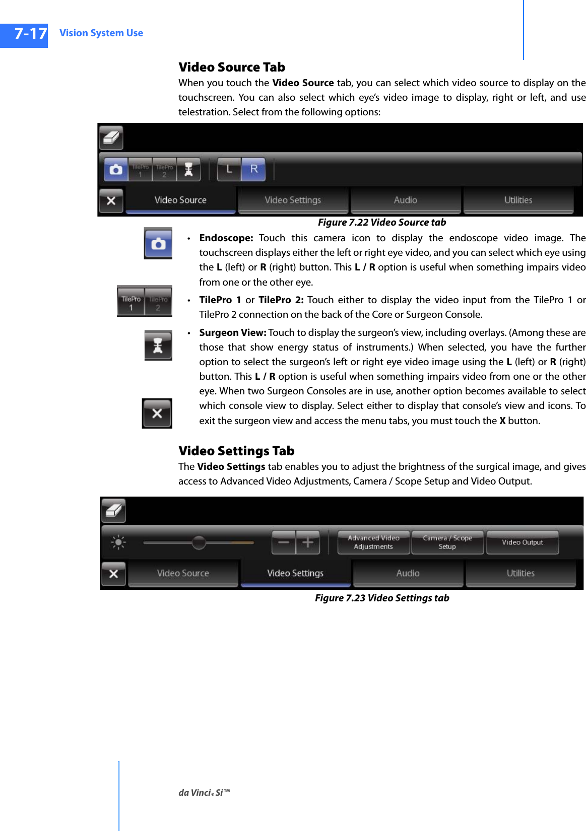 Vision System Useda Vinci® Si™7-17DRAFT/PRE-RELEASE/CONFIDENTIAL10/9/14Video Source TabWhen you touch the Video Source tab, you can select which video source to display on the touchscreen. You can also select which eye’s video image to display, right or left, and use telestration. Select from the following options:Figure 7.22 Video Source tab•Endoscope:  Touch this camera icon to display the endoscope video image. The touchscreen displays either the left or right eye video, and you can select which eye using the L (left) or R (right) button. This L / R option is useful when something impairs video from one or the other eye.•TilePro 1 or TilePro 2: Touch either to display the video input from the TilePro 1 or TilePro 2 connection on the back of the Core or Surgeon Console.•Surgeon View: Touch to display the surgeon’s view, including overlays. (Among these are those that show energy status of instruments.) When selected, you have the further option to select the surgeon’s left or right eye video image using the L (left) or R (right) button. This L / R option is useful when something impairs video from one or the other eye. When two Surgeon Consoles are in use, another option becomes available to select which console view to display. Select either to display that console’s view and icons. To exit the surgeon view and access the menu tabs, you must touch the X button.Video Settings TabThe Video Settings tab enables you to adjust the brightness of the surgical image, and gives access to Advanced Video Adjustments, Camera / Scope Setup and Video Output.Figure 7.23 Video Settings tab