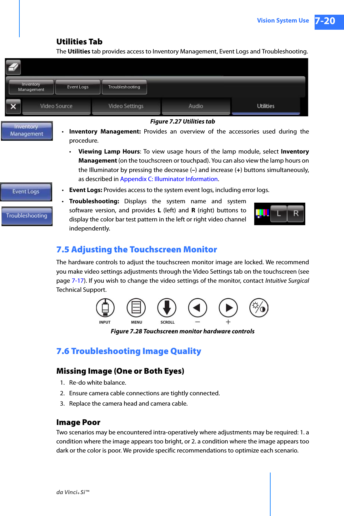 da Vinci® Si™Vision System Use 7-20DRAFT/PRE-RELEASE/CONFIDENTIAL 10/9/14Utilities TabThe Utilities tab provides access to Inventory Management, Event Logs and Troubleshooting.Figure 7.27 Utilities tab•Inventory Management: Provides an overview of the accessories used during the procedure. •Viewing Lamp Hours: To view usage hours of the lamp module, select Inventory Management (on the touchscreen or touchpad). You can also view the lamp hours on the Illuminator by pressing the decrease (–) and increase (+) buttons simultaneously, as described in Appendix C: Illuminator Information.•Event Logs: Provides access to the system event logs, including error logs.•Troubleshooting:  Displays the system name and system software version, and provides L  (left) and R  (right) buttons to display the color bar test pattern in the left or right video channel independently.7.5 Adjusting the Touchscreen MonitorThe hardware controls to adjust the touchscreen monitor image are locked. We recommend you make video settings adjustments through the Video Settings tab on the touchscreen (see page 7-17). If you wish to change the video settings of the monitor, contact Intuitive SurgicalTechnical Support. Figure 7.28 Touchscreen monitor hardware controls7.6 Troubleshooting Image QualityMissing Image (One or Both Eyes)1. Re-do white balance.2. Ensure camera cable connections are tightly connected.3. Replace the camera head and camera cable.Image PoorTwo scenarios may be encountered intra-operatively where adjustments may be required: 1. a condition where the image appears too bright, or 2. a condition where the image appears too dark or the color is poor. We provide specific recommendations to optimize each scenario. 