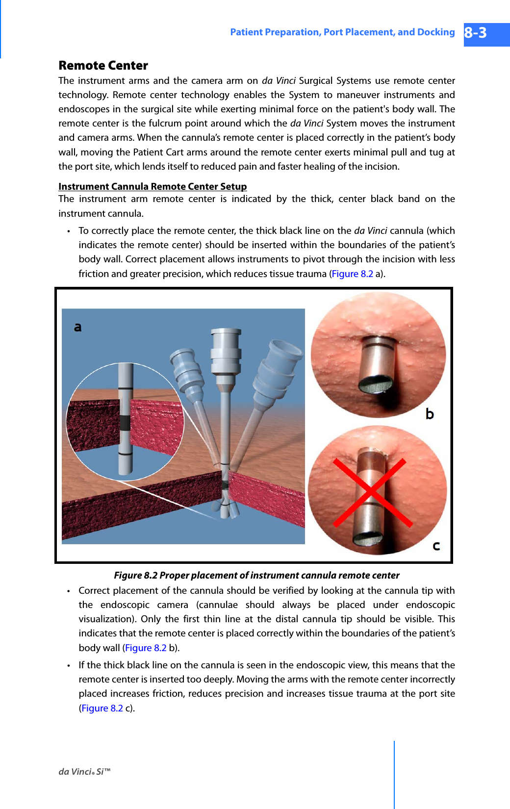 da Vinci® Si™Patient Preparation, Port Placement, and Docking 8-3DRAFT/PRE-RELEASE/CONFIDENTIAL 10/9/14Remote CenterThe instrument arms and the camera arm on da Vinci Surgical Systems use remote center technology. Remote center technology enables the System to maneuver instruments and endoscopes in the surgical site while exerting minimal force on the patient&apos;s body wall. The remote center is the fulcrum point around which the da Vinci System moves the instrument and camera arms. When the cannula’s remote center is placed correctly in the patient’s body wall, moving the Patient Cart arms around the remote center exerts minimal pull and tug at the port site, which lends itself to reduced pain and faster healing of the incision.Instrument Cannula Remote Center SetupThe instrument arm remote center is indicated by the thick, center black band on the instrument cannula.• To correctly place the remote center, the thick black line on the da Vinci cannula (which indicates the remote center) should be inserted within the boundaries of the patient’s body wall. Correct placement allows instruments to pivot through the incision with less friction and greater precision, which reduces tissue trauma (Figure 8.2 a).Figure 8.2 Proper placement of instrument cannula remote center • Correct placement of the cannula should be verified by looking at the cannula tip with the endoscopic camera (cannulae should always be placed under endoscopic visualization). Only the first thin line at the distal cannula tip should be visible. This indicates that the remote center is placed correctly within the boundaries of the patient’s body wall (Figure 8.2 b).• If the thick black line on the cannula is seen in the endoscopic view, this means that the remote center is inserted too deeply. Moving the arms with the remote center incorrectly placed increases friction, reduces precision and increases tissue trauma at the port site (Figure 8.2 c).