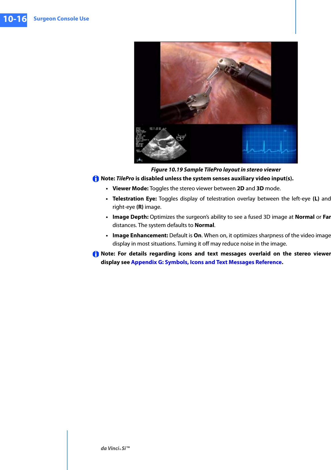 Surgeon Console Useda Vinci® Si™10-16DRAFT/PRE-RELEASE/CONFIDENTIAL10/9/14Figure 10.19 Sample TilePro layout in stereo viewerNote: TilePro is disabled unless the system senses auxiliary video input(s).•Viewer Mode: Toggles the stereo viewer between 2D and 3D mode. • Telestration Eye: Toggles display of telestration overlay between the left-eye (L) and right-eye (R) image.• Image Depth: Optimizes the surgeon’s ability to see a fused 3D image at Normal or Fardistances. The system defaults to Normal. • Image Enhancement: Default is On. When on, it optimizes sharpness of the video image display in most situations. Turning it off may reduce noise in the image.Note: For details regarding icons and text messages overlaid on the stereo viewer display see Appendix G: Symbols, Icons and Text Messages Reference.