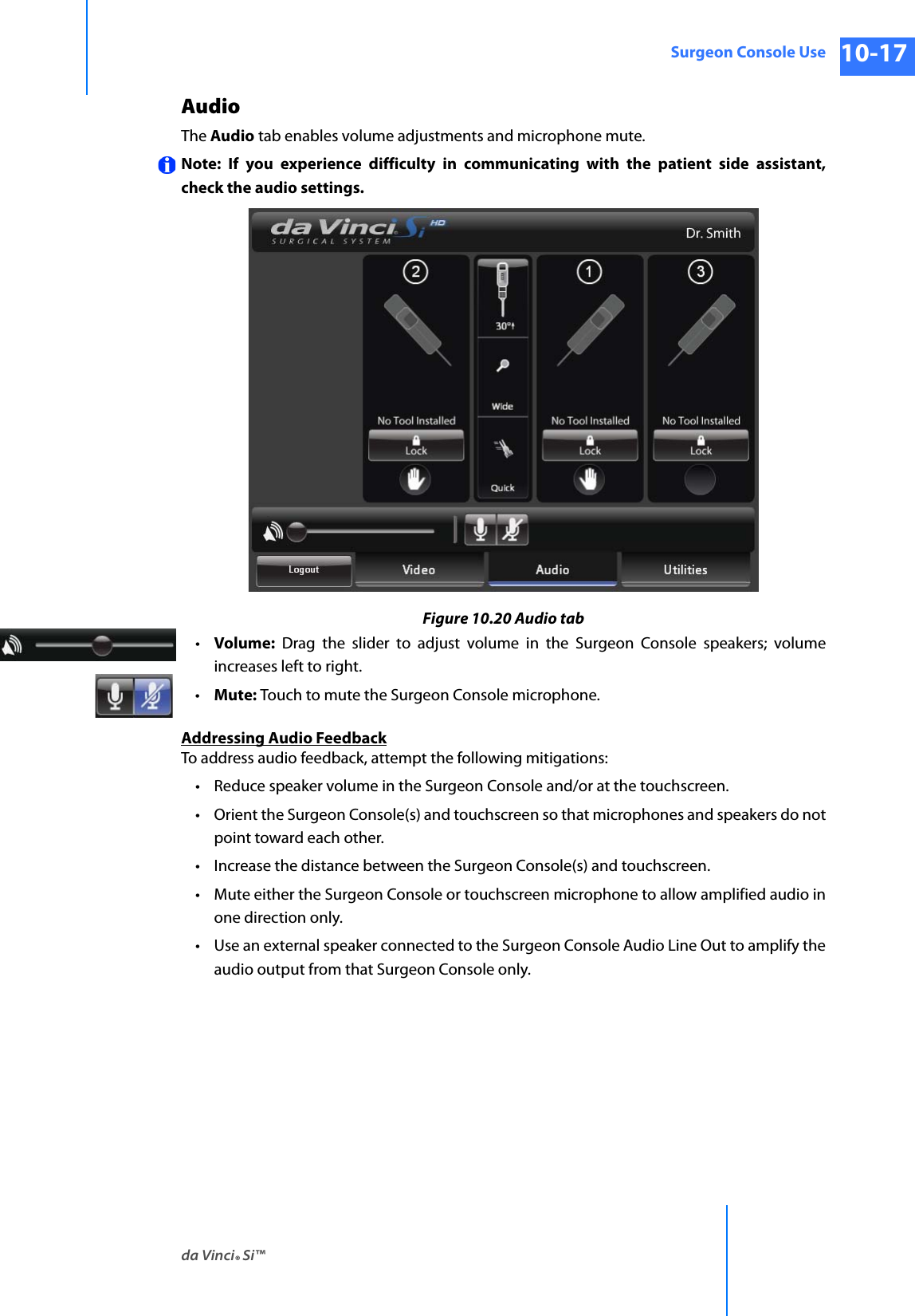 da Vinci® Si™Surgeon Console Use 10-17DRAFT/PRE-RELEASE/CONFIDENTIAL 10/9/14AudioThe Audio tab enables volume adjustments and microphone mute.Note: If you experience difficulty in communicating with the patient side assistant, check the audio settings.Figure 10.20 Audio tab•Volume: Drag the slider to adjust volume in the Surgeon Console speakers; volume increases left to right.•Mute: Touch to mute the Surgeon Console microphone.Addressing Audio FeedbackTo address audio feedback, attempt the following mitigations:• Reduce speaker volume in the Surgeon Console and/or at the touchscreen.• Orient the Surgeon Console(s) and touchscreen so that microphones and speakers do not point toward each other.• Increase the distance between the Surgeon Console(s) and touchscreen.• Mute either the Surgeon Console or touchscreen microphone to allow amplified audio in one direction only.• Use an external speaker connected to the Surgeon Console Audio Line Out to amplify the audio output from that Surgeon Console only.