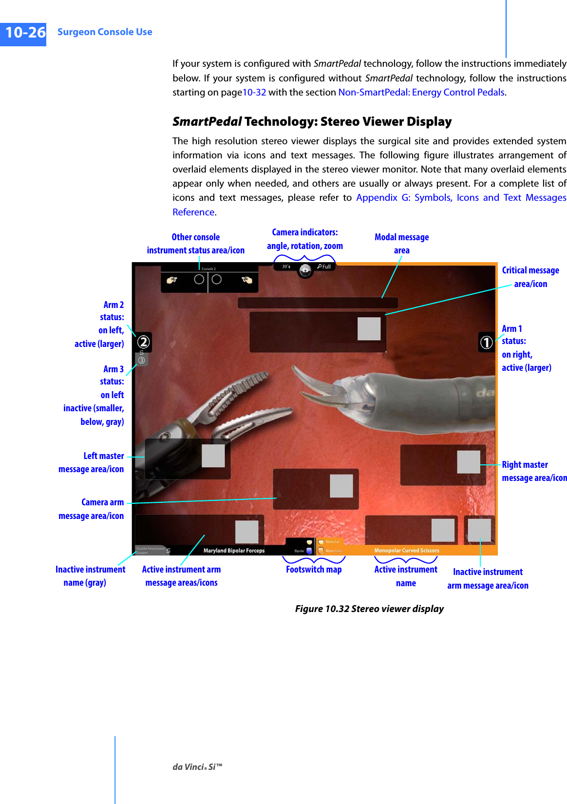 Surgeon Console Useda Vinci® Si™10-26DRAFT/PRE-RELEASE/CONFIDENTIAL10/9/14If your system is configured with SmartPedal technology, follow the instructions immediately below. If your system is configured without SmartPedal technology, follow the instructionsstarting on page10-32 with the section Non-SmartPedal: Energy Control Pedals.SmartPedal Technology: Stereo Viewer DisplayThe high resolution stereo viewer displays the surgical site and provides extended system information via icons and text messages. The following figure illustrates arrangement of overlaid elements displayed in the stereo viewer monitor. Note that many overlaid elements appear only when needed, and others are usually or always present. For a complete list of icons and text messages, please refer to Appendix G: Symbols, Icons and Text Messages Reference.Figure 10.32 Stereo viewer displayCamera indicators:angle, rotation, zoom Modal messageareaCritical messagearea/iconArm 1status:on right,active (larger)Arm 3status:on leftinactive (smaller,below, gray)Arm 2status:on left,active (larger)Footswitch map Active instrumentnameActive instrument armmessage areas/iconsInactive instrumentarm message area/iconLeft mastermessage area/icon Right mastermessage area/iconCamera armmessage area/iconOther consoleinstrument status area/icon      Inactive instrument name (gray)