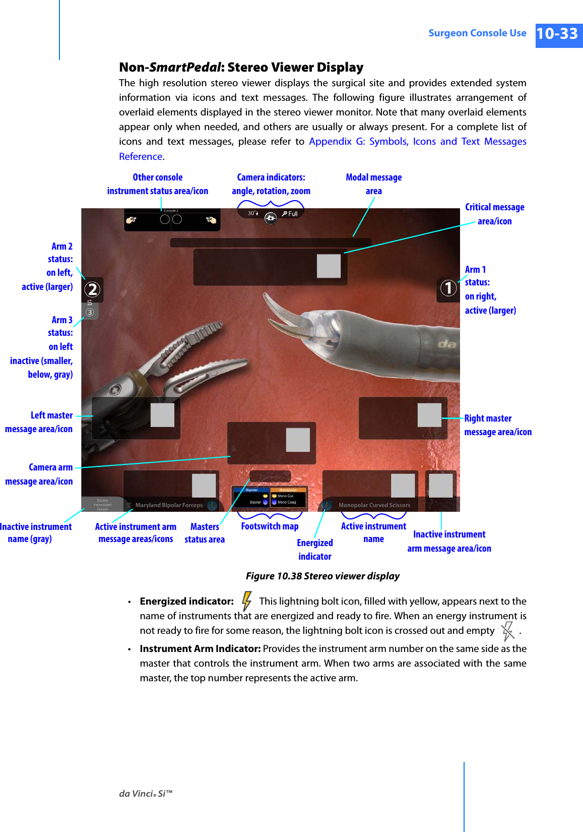 da Vinci® Si™Surgeon Console Use 10-33DRAFT/PRE-RELEASE/CONFIDENTIAL 10/9/14Non-SmartPedal: Stereo Viewer DisplayThe high resolution stereo viewer displays the surgical site and provides extended system information via icons and text messages. The following figure illustrates arrangement of overlaid elements displayed in the stereo viewer monitor. Note that many overlaid elements appear only when needed, and others are usually or always present. For a complete list of icons and text messages, please refer to Appendix G: Symbols, Icons and Text Messages Reference.Figure 10.38 Stereo viewer display•Energized indicator: This lightning bolt icon, filled with yellow, appears next to the name of instruments that are energized and ready to fire. When an energy instrument is not ready to fire for some reason, the lightning bolt icon is crossed out and empty  .•Instrument Arm Indicator: Provides the instrument arm number on the same side as the master that controls the instrument arm. When two arms are associated with the same master, the top number represents the active arm.EnergizedindicatorMastersstatus areaCritical messagearea/iconModal messageareaCamera indicators:angle, rotation, zoomOther consoleinstrument status area/iconArm 2status:on left,active (larger)Arm 3status:on leftinactive (smaller,below, gray)Left mastermessage area/iconCamera armmessage area/iconArm 1status:on right,active (larger)Right mastermessage area/icon        Inactive instrument name (gray)Footswitch mapActive instrument armmessage areas/iconsActive instrumentname Inactive instrumentarm message area/icon