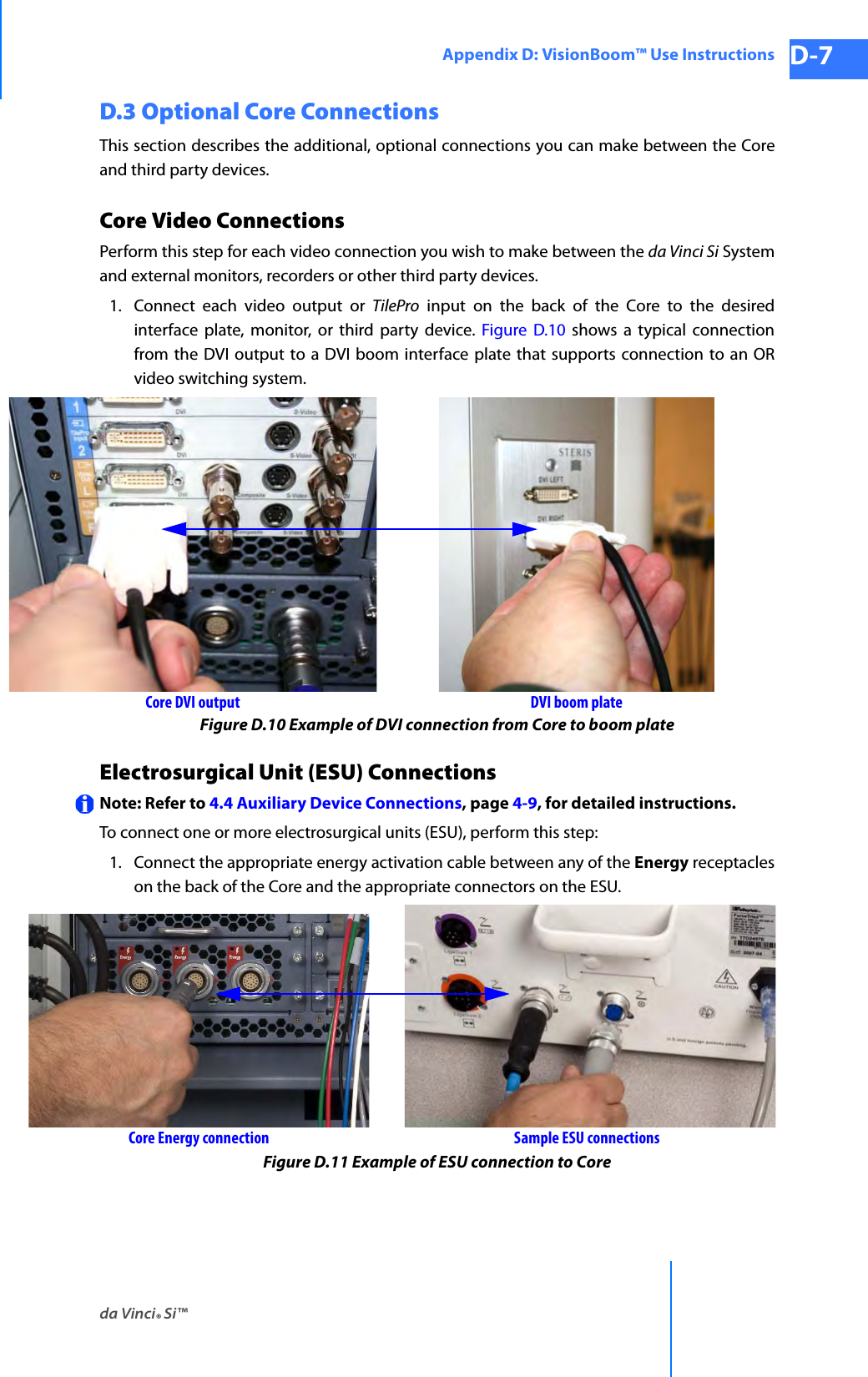 da Vinci® Si™Appendix D: VisionBoom™ Use Instructions D-7DRAFT/PRE-RELEASE/CONFIDENTIAL 10/9/14D.3 Optional Core ConnectionsThis section describes the additional, optional connections you can make between the Core and third party devices.Core Video ConnectionsPerform this step for each video connection you wish to make between the da Vinci Si System and external monitors, recorders or other third party devices.1. Connect each video output or TilePro input on the back of the Core to the desired interface plate, monitor, or third party device. Figure D.10 shows a typical connection from the DVI output to a DVI boom interface plate that supports connection to an OR video switching system.Figure D.10 Example of DVI connection from Core to boom plateElectrosurgical Unit (ESU) ConnectionsNote: Refer to 4.4 Auxiliary Device Connections, page 4-9, for detailed instructions.To connect one or more electrosurgical units (ESU), perform this step:1. Connect the appropriate energy activation cable between any of the Energy receptacles on the back of the Core and the appropriate connectors on the ESU.Figure D.11 Example of ESU connection to CoreCore DVI output DVI boom plateSample ESU connectionsCore Energy connection