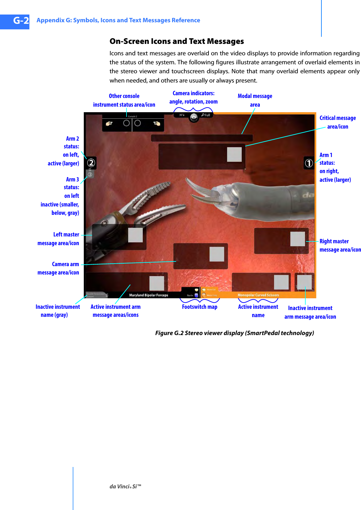 Appendix G: Symbols, Icons and Text Messages Referenceda Vinci® Si™G-2DRAFT/PRE-RELEASE/CONFIDENTIAL10/9/14On-Screen Icons and Text MessagesIcons and text messages are overlaid on the video displays to provide information regarding the status of the system. The following figures illustrate arrangement of overlaid elements in the stereo viewer and touchscreen displays. Note that many overlaid elements appear only when needed, and others are usually or always present.Figure G.2 Stereo viewer display (SmartPedal technology) Critical messagearea/iconArm 1status:on right,active (larger)Right mastermessage area/iconangle, rotation, zoom Modal messageareaOther consoleinstrument status area/iconCamera indicators:Arm 3status:on leftinactive (smaller,below, gray)Arm 2status:on left,active (larger)Left mastermessage area/iconCamera armmessage area/iconname (gray)        Inactive instrument  Footswitch map Active instrumentnameActive instrument armmessage areas/iconsInactive instrumentarm message area/icon