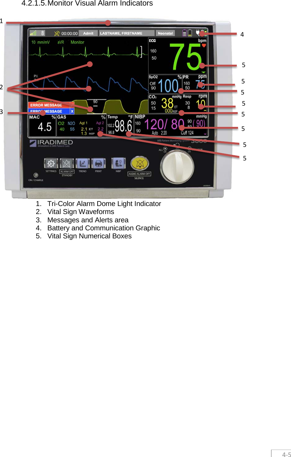  4-5  4.2.1.5. Monitor Visual Alarm Indicators      1. Tri-Color Alarm Dome Light Indicator 2. Vital Sign Waveforms 3. Messages and Alerts area 4. Battery and Communication Graphic 5. Vital Sign Numerical Boxes  5 2 1 4 5 5 5 5 5 5 5 3 