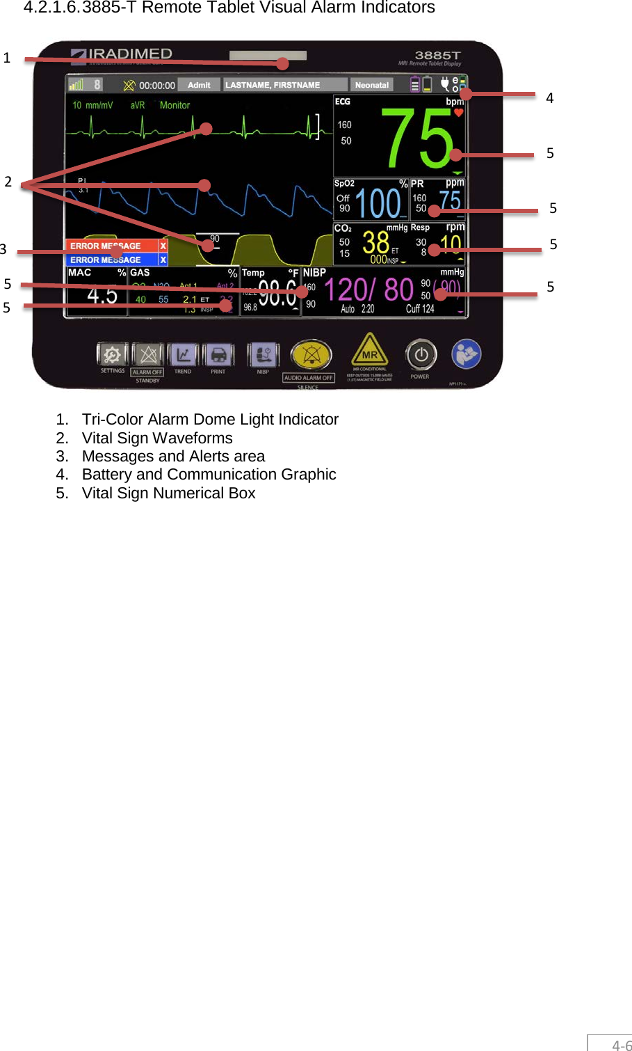  4-6 4.2.1.6. 3885-T Remote Tablet Visual Alarm Indicators   1. Tri-Color Alarm Dome Light Indicator 2. Vital Sign Waveforms 3. Messages and Alerts area 4. Battery and Communication Graphic 5. Vital Sign Numerical Box    4 1 5 2 3 5 5 5 5 5 
