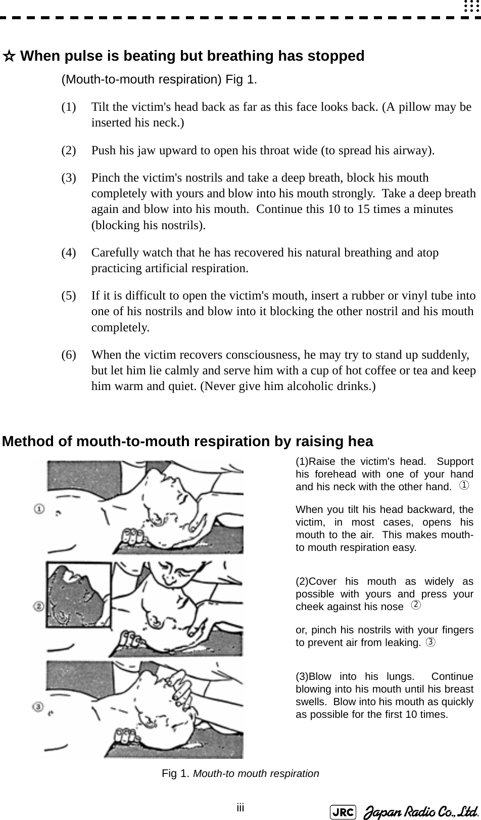 iii☆When pulse is beating but breathing has stopped(Mouth-to-mouth respiration) Fig 1.(1) Tilt the victim&apos;s head back as far as this face looks back. (A pillow may be inserted his neck.)(2) Push his jaw upward to open his throat wide (to spread his airway).(3) Pinch the victim&apos;s nostrils and take a deep breath, block his mouth completely with yours and blow into his mouth strongly.  Take a deep breath again and blow into his mouth.  Continue this 10 to 15 times a minutes (blocking his nostrils).(4) Carefully watch that he has recovered his natural breathing and atop practicing artificial respiration.(5) If it is difficult to open the victim&apos;s mouth, insert a rubber or vinyl tube into one of his nostrils and blow into it blocking the other nostril and his mouth completely.(6) When the victim recovers consciousness, he may try to stand up suddenly, but let him lie calmly and serve him with a cup of hot coffee or tea and keep him warm and quiet. (Never give him alcoholic drinks.)Method of mouth-to-mouth respiration by raising heaFig 1. Mouth-to mouth respiration(1)Raise the victim&apos;s head.  Supporthis forehead with one of your handand his neck with the other hand.  When you tilt his head backward, thevictim, in most cases, opens hismouth to the air.  This makes mouth-to mouth respiration easy.(2)Cover his mouth as widely aspossible with yours and press yourcheek against his nose    or, pinch his nostrils with your fingersto prevent air from leaking. (3)Blow into his lungs.  Continueblowing into his mouth until his breastswells.  Blow into his mouth as quicklyas possible for the first 10 times.123