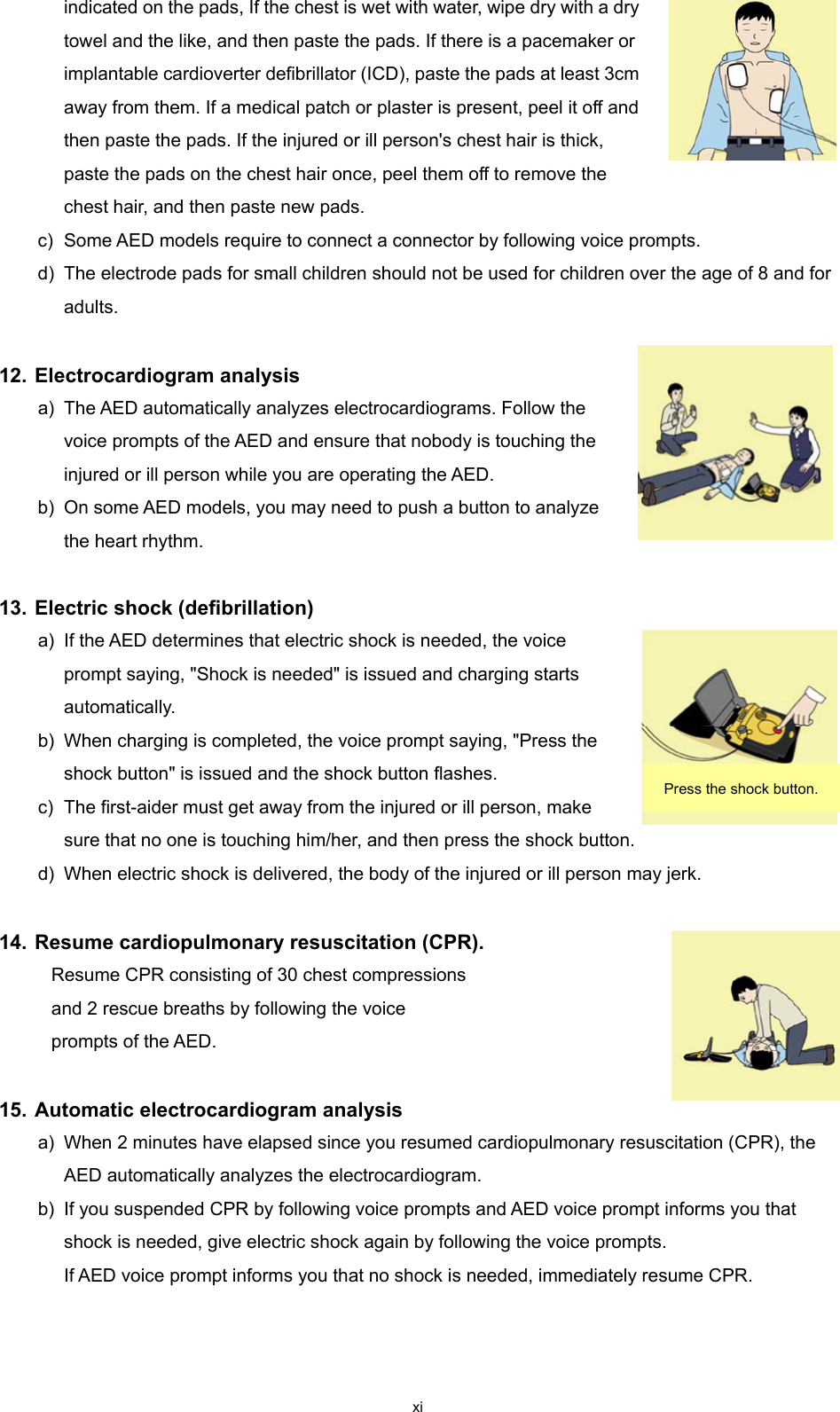 xi indicated on the pads, If the chest is wet with water, wipe dry with a dry towel and the like, and then paste the pads. If there is a pacemaker or implantable cardioverter defibrillator (ICD), paste the pads at least 3cm away from them. If a medical patch or plaster is present, peel it off and then paste the pads. If the injured or ill person&apos;s chest hair is thick, paste the pads on the chest hair once, peel them off to remove the chest hair, and then paste new pads. c) Some AED models require to connect a connector by following voice prompts. d) The electrode pads for small children should not be used for children over the age of 8 and for adults.  12. Electrocardiogram analysis a) The AED automatically analyzes electrocardiograms. Follow the voice prompts of the AED and ensure that nobody is touching the injured or ill person while you are operating the AED. b) On some AED models, you may need to push a button to analyze the heart rhythm.  13. Electric shock (defibrillation) a) If the AED determines that electric shock is needed, the voice prompt saying, &quot;Shock is needed&quot; is issued and charging starts automatically. b) When charging is completed, the voice prompt saying, &quot;Press the shock button&quot; is issued and the shock button flashes. c) The first-aider must get away from the injured or ill person, make sure that no one is touching him/her, and then press the shock button. d) When electric shock is delivered, the body of the injured or ill person may jerk.  14. Resume cardiopulmonary resuscitation (CPR). Resume CPR consisting of 30 chest compressions and 2 rescue breaths by following the voice prompts of the AED.  15. Automatic electrocardiogram analysis a) When 2 minutes have elapsed since you resumed cardiopulmonary resuscitation (CPR), the AED automatically analyzes the electrocardiogram. b) If you suspended CPR by following voice prompts and AED voice prompt informs you that shock is needed, give electric shock again by following the voice prompts.  If AED voice prompt informs you that no shock is needed, immediately resume CPR.    Press the shock button. 