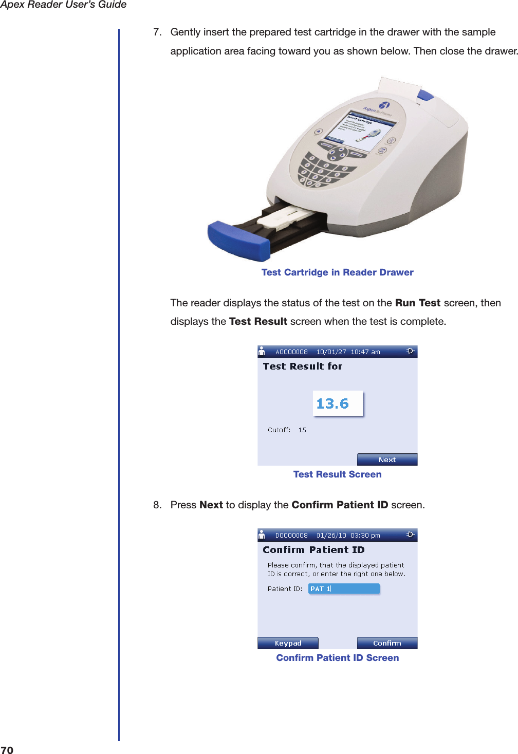 Apex Reader User&rsquo;s Guide707. Gently insert the prepared test cartridge in the drawer with the sample application area facing toward you as shown below. Then close the drawer.The reader displays the status of the test on the Run Test screen, then displays the Test Result screen when the test is complete.8. Press Next to display the Confirm Patient ID screen.Test Cartridge in Reader DrawerTest Result ScreenConfirm Patient ID Screen