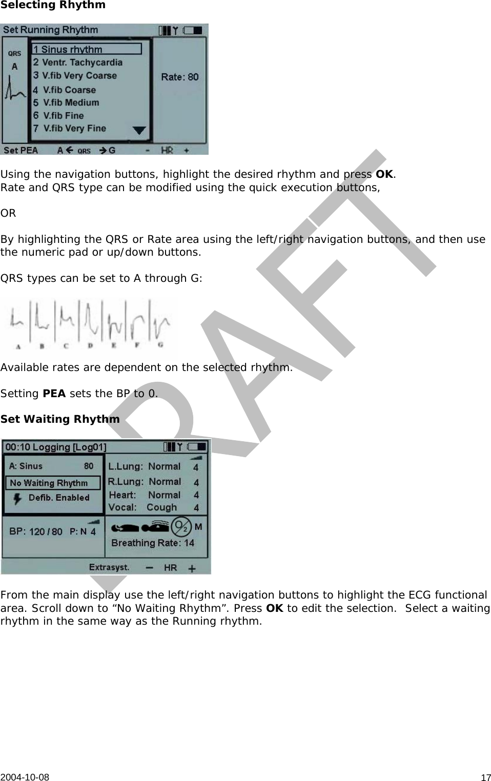  2004-10-08   17Selecting Rhythm    Using the navigation buttons, highlight the desired rhythm and press OK.  Rate and QRS type can be modified using the quick execution buttons,  OR  By highlighting the QRS or Rate area using the left/right navigation buttons, and then use the numeric pad or up/down buttons.  QRS types can be set to A through G:   Available rates are dependent on the selected rhythm.  Setting PEA sets the BP to 0.  Set Waiting Rhythm    From the main display use the left/right navigation buttons to highlight the ECG functional area. Scroll down to “No Waiting Rhythm”. Press OK to edit the selection.  Select a waiting rhythm in the same way as the Running rhythm.  