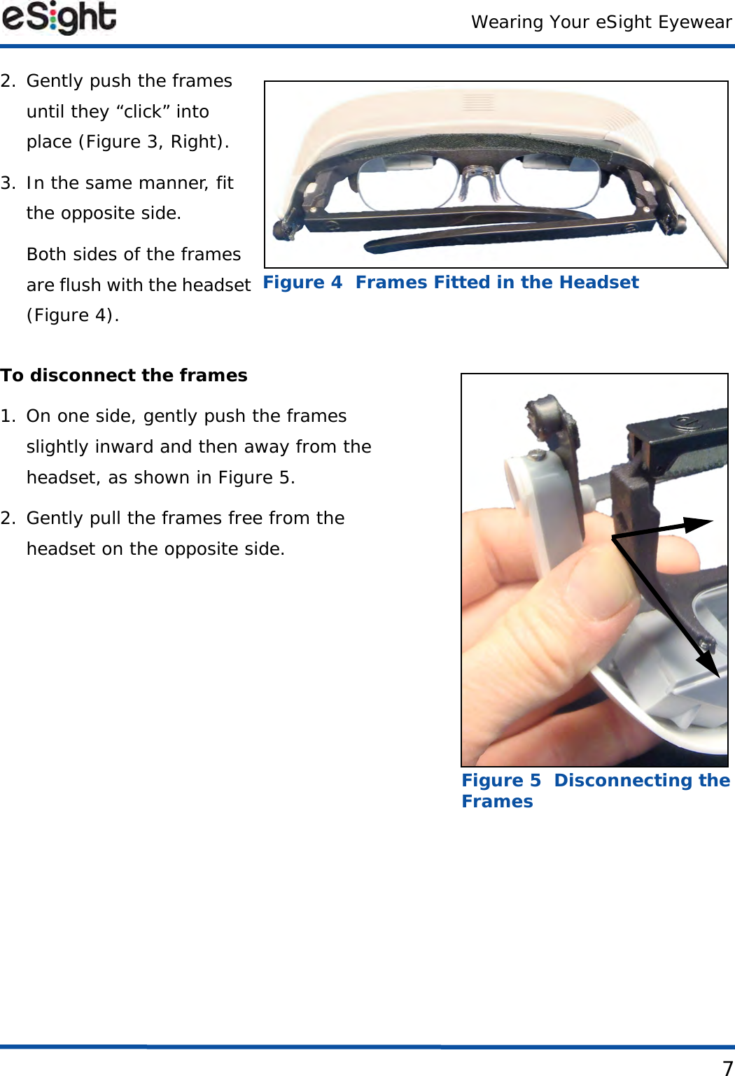 Wearing Your eSight Eyewear72. Gently push the frames until they “click” into place (Figure 3, Right).3. In the same manner, fit the opposite side.Both sides of the frames are flush with the headset (Figure 4).To disconnect the frames1. On one side, gently push the frames slightly inward and then away from the headset, as shown in Figure 5.2. Gently pull the frames free from the headset on the opposite side.PLACEHOLDERFigure 4  Frames Fitted in the HeadsetFigure 5  Disconnecting the Frames