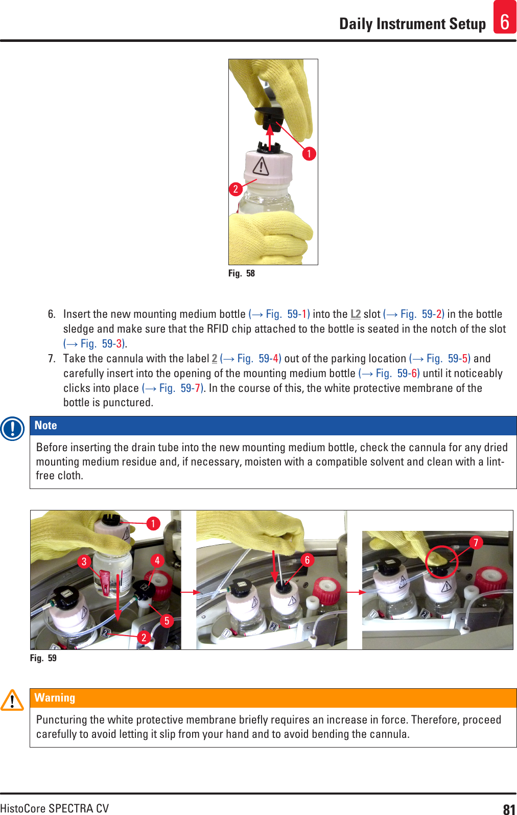 81HistoCore SPECTRA CVDaily Instrument Setup 6Fig. 58   126.  Insert the new mounting medium bottle (→ Fig.  59-1) into the L2 slot (→ Fig.  59-2) in the bottle sledge and make sure that the RFID chip attached to the bottle is seated in the notch of the slot (→ Fig.  59-3).7.  Take the cannula with the label 2 (→ Fig.  59-4) out of the parking location (→ Fig.  59-5) and carefully insert into the opening of the mounting medium bottle (→ Fig.  59-6) until it noticeably clicks into place (→ Fig.  59-7). In the course of this, the white protective membrane of the bottle is punctured.Note Before inserting the drain tube into the new mounting medium bottle, check the cannula for any dried mounting medium residue and, if necessary, moisten with a compatible solvent and clean with a lint-free cloth.Fig. 59   1627345WarningPuncturing the white protective membrane briefly requires an increase in force. Therefore, proceed carefully to avoid letting it slip from your hand and to avoid bending the cannula. 