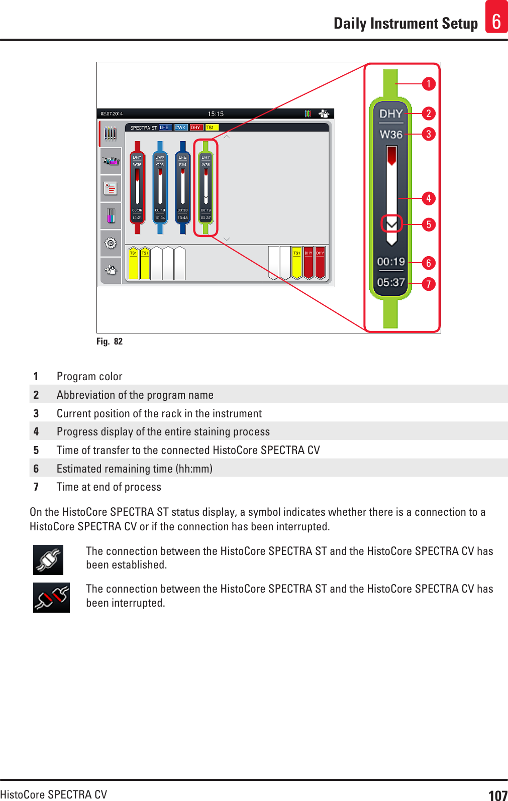 107HistoCore SPECTRA CVDaily Instrument Setup 66723451Fig. 82   1Program color2Abbreviation of the program name3Current position of the rack in the instrument4Progress display of the entire staining process5Time of transfer to the connected HistoCore SPECTRA CV6Estimated remaining time (hh:mm)7Time at end of processOn the HistoCore SPECTRA ST status display, a symbol indicates whether there is a connection to a HistoCore SPECTRA CV or if the connection has been interrupted.The connection between the HistoCore SPECTRA ST and the HistoCore SPECTRA CV has been established.The connection between the HistoCore SPECTRA ST and the HistoCore SPECTRA CV has been interrupted.
