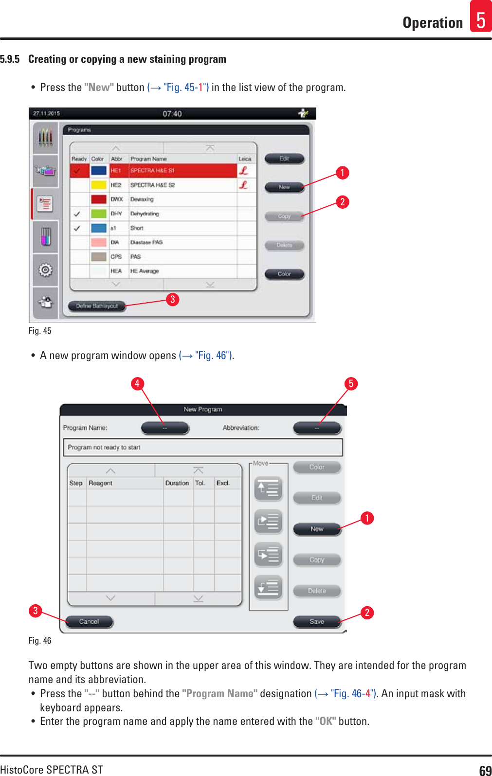 69HistoCore SPECTRA STOperation 55.9.5  Creating or copying a new staining program• Press the &quot;New&quot; button (→ &quot;Fig. 45-1&quot;) in the list view of the program. 132Fig. 45   • A new program window opens (→ &quot;Fig. 46&quot;).15324Fig. 46   Two empty buttons are shown in the upper area of this window. They are intended for the program name and its abbreviation.• Press the &quot;--&quot; button behind the &quot;Program Name&quot; designation (→ &quot;Fig. 46-4&quot;). An input mask with keyboard appears. • Enter the program name and apply the name entered with the &quot;OK&quot; button.