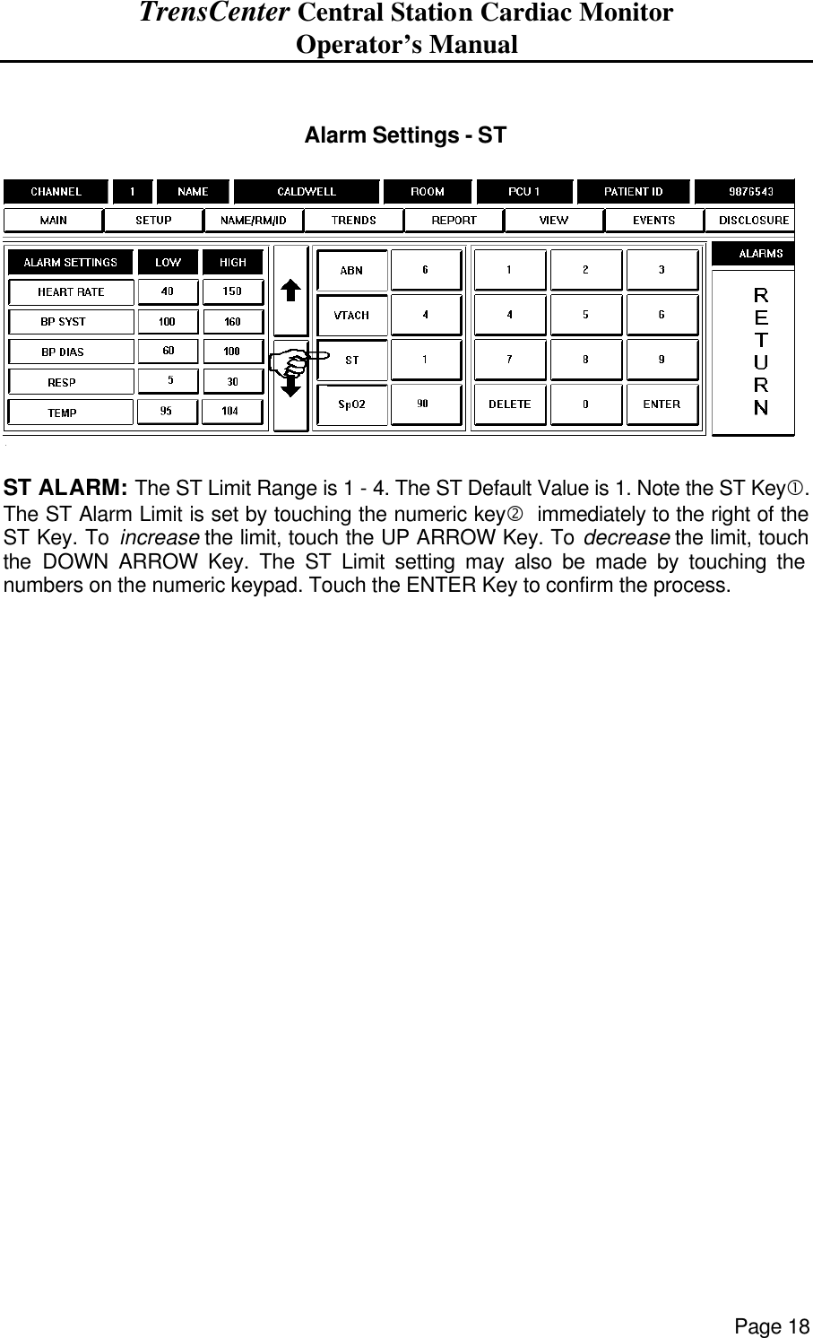 TrensCenter Central Station Cardiac Monitor Operator’s Manual Page 18   Alarm Settings - ST    ST ALARM: The ST Limit Range is 1 - 4. The ST Default Value is 1. Note the ST Key•. The ST Alarm Limit is set by touching the numeric key‚  immediately to the right of the ST Key. To increase the limit, touch the UP ARROW Key. To decrease the limit, touch the DOWN ARROW Key. The ST Limit setting may also be made by touching the numbers on the numeric keypad. Touch the ENTER Key to confirm the process.      