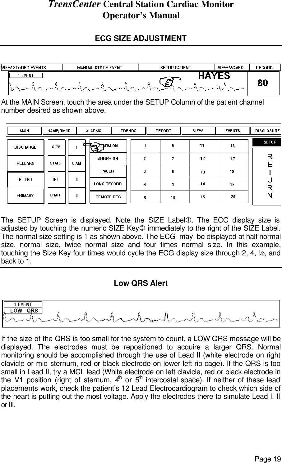 TrensCenter Central Station Cardiac Monitor Operator’s Manual Page 19  ECG SIZE ADJUSTMENT    At the MAIN Screen, touch the area under the SETUP Column of the patient channel number desired as shown above.   The SETUP Screen is displayed. Note the SIZE Label•. The ECG display size is adjusted by touching the numeric SIZE Key‚ immediately to the right of the SIZE Label. The normal size setting is 1 as shown above. The ECG  may  be displayed at half normal size, normal size, twice normal size and four times normal size. In this example, touching the Size Key four times would cycle the ECG display size through 2, 4, ½, and back to 1.  Low QRS Alert   If the size of the QRS is too small for the system to count, a LOW QRS message will be displayed. The electrodes must be repositioned to acquire a larger QRS. Normal monitoring should be accomplished through the use of Lead II (white electrode on right clavicle or mid sternum, red or black electrode on lower left rib cage). If the QRS is too small in Lead II, try a MCL lead (White electrode on left clavicle, red or black electrode in the V1 position (right of sternum, 4th or 5th intercostal space). If neither of these lead placements work, check the patient’s 12 Lead Electrocardiogram to check which side of the heart is putting out the most voltage. Apply the electrodes there to simulate Lead I, II or III. 