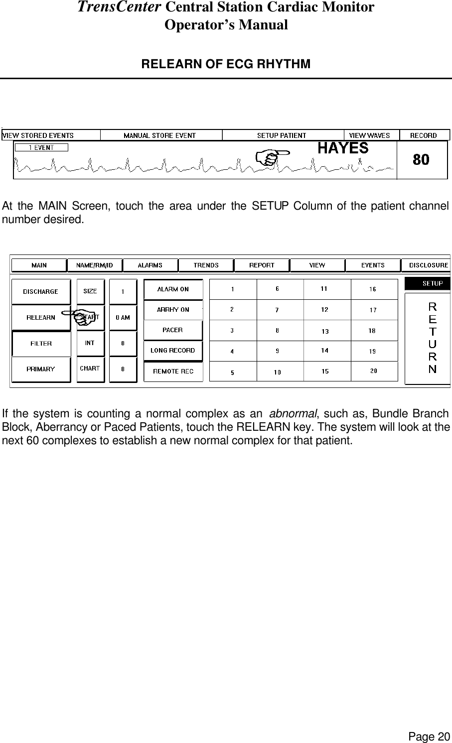 TrensCenter Central Station Cardiac Monitor Operator’s Manual Page 20  RELEARN OF ECG RHYTHM      At the MAIN Screen, touch the area under the SETUP Column of the patient channel number desired.    If the system is counting a normal complex as an abnormal, such as, Bundle Branch Block, Aberrancy or Paced Patients, touch the RELEARN key. The system will look at the next 60 complexes to establish a new normal complex for that patient. 