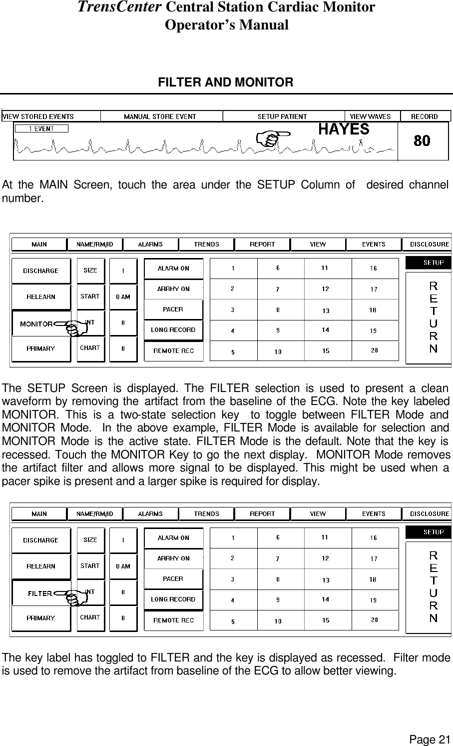 TrensCenter Central Station Cardiac Monitor Operator’s Manual Page 21   FILTER AND MONITOR    At the MAIN Screen, touch the area under the SETUP Column of  desired channel number.    The SETUP Screen is displayed. The FILTER selection is used to present a clean waveform by removing the artifact from the baseline of the ECG. Note the key labeled MONITOR. This is a two-state selection key  to toggle between FILTER Mode and MONITOR Mode.  In the above example, FILTER Mode is available for selection and MONITOR Mode is the active state. FILTER Mode is the default. Note that the key is  recessed. Touch the MONITOR Key to go the next display.  MONITOR Mode removes the artifact filter and allows more signal to be displayed. This might be used when a pacer spike is present and a larger spike is required for display.   The key label has toggled to FILTER and the key is displayed as recessed.  Filter mode is used to remove the artifact from baseline of the ECG to allow better viewing.  