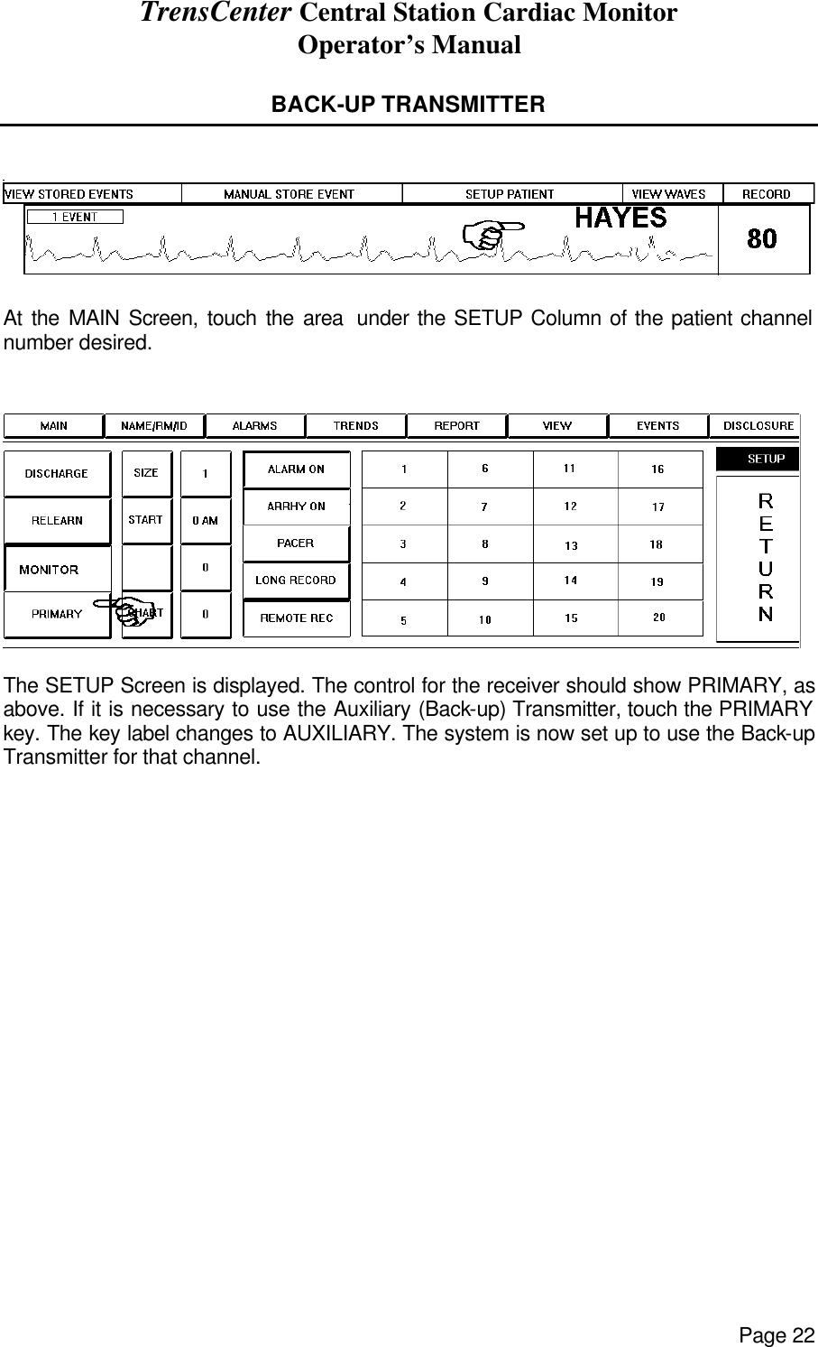 TrensCenter Central Station Cardiac Monitor Operator’s Manual Page 22  BACK-UP TRANSMITTER     At the MAIN Screen, touch the area  under the SETUP Column of the patient channel number desired.    The SETUP Screen is displayed. The control for the receiver should show PRIMARY, as above. If it is necessary to use the Auxiliary (Back-up) Transmitter, touch the PRIMARY key. The key label changes to AUXILIARY. The system is now set up to use the Back-up Transmitter for that channel. 