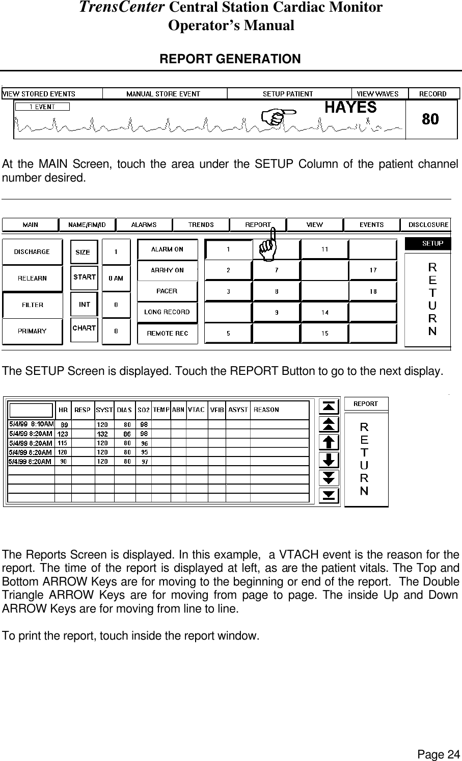 TrensCenter Central Station Cardiac Monitor Operator’s Manual Page 24  REPORT GENERATION    At the MAIN Screen, touch the area under the SETUP Column of the patient channel number desired.    The SETUP Screen is displayed. Touch the REPORT Button to go to the next display.  The Reports Screen is displayed. In this example,  a VTACH event is the reason for the report. The time of the report is displayed at left, as are the patient vitals. The Top and Bottom ARROW Keys are for moving to the beginning or end of the report.  The Double Triangle ARROW Keys are for moving from page to page. The inside Up and Down ARROW Keys are for moving from line to line.  To print the report, touch inside the report window.  