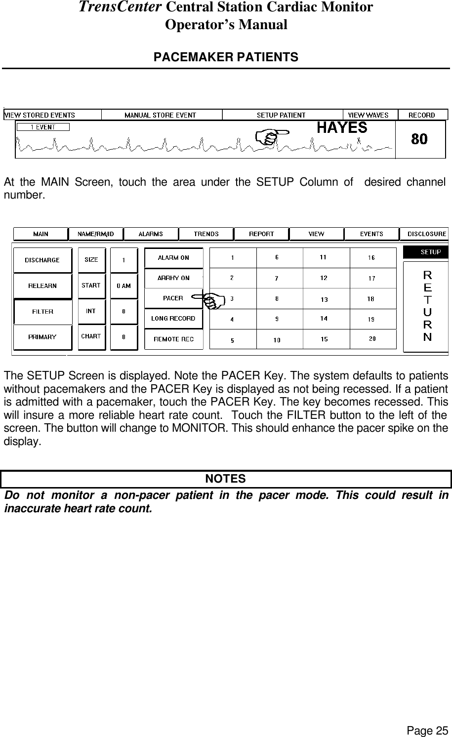 TrensCenter Central Station Cardiac Monitor Operator’s Manual Page 25  PACEMAKER PATIENTS    At the MAIN Screen, touch the area under the SETUP Column of  desired channel number.   The SETUP Screen is displayed. Note the PACER Key. The system defaults to patients without pacemakers and the PACER Key is displayed as not being recessed. If a patient is admitted with a pacemaker, touch the PACER Key. The key becomes recessed. This will insure a more reliable heart rate count.  Touch the FILTER button to the left of the screen. The button will change to MONITOR. This should enhance the pacer spike on the display.  NOTES Do not monitor a non-pacer patient in the pacer mode. This could result in inaccurate heart rate count. 