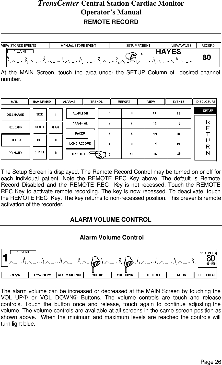 TrensCenter Central Station Cardiac Monitor Operator’s Manual Page 26 REMOTE RECORD                At the MAIN Screen, touch the area under the SETUP Column of  desired channel number.    The Setup Screen is displayed. The Remote Record Control may be turned on or off for each individual patient. Note the REMOTE REC Key above. The default is Remote Record Disabled and the REMOTE REC  Key is not recessed. Touch the REMOTE REC Key to activate remote recording. The key is now recessed. To deactivate, touch the REMOTE REC  Key. The key returns to non-recessed position. This prevents remote activation of the recorder.  ALARM VOLUME CONTROL   Alarm Volume Control    The alarm volume can be increased or decreased at the MAIN Screen by touching the VOL UP• or VOL DOWN‚ Buttons. The volume controls are touch and release controls. Touch the button once and release, touch again to continue adjusting the volume. The volume controls are available at all screens in the same screen position as shown above.  When the minimum and maximum levels are reached the controls will turn light blue. 