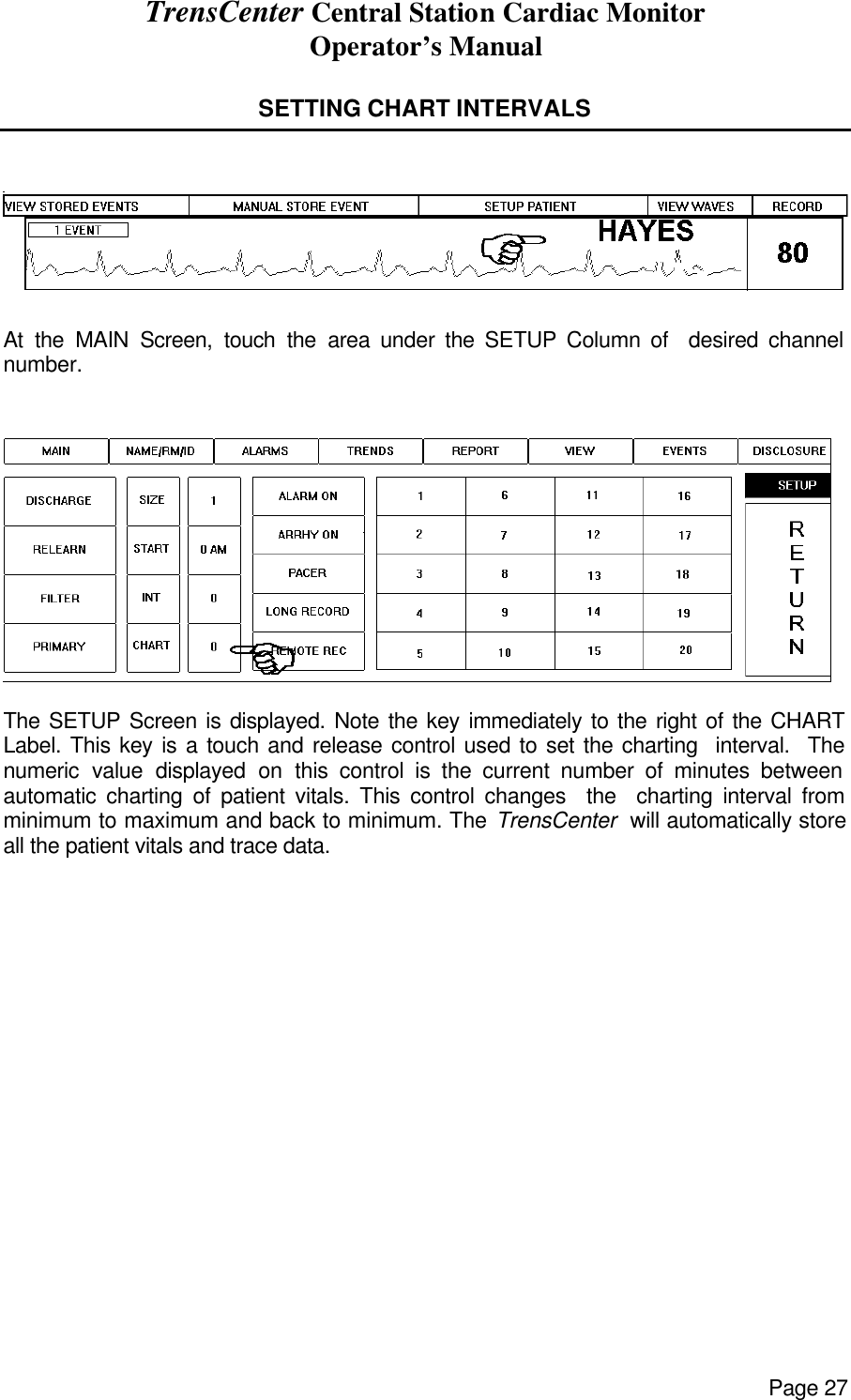 TrensCenter Central Station Cardiac Monitor Operator’s Manual Page 27  SETTING CHART INTERVALS     At the MAIN Screen, touch the area under the SETUP Column of  desired channel number.    The SETUP Screen is displayed. Note the key immediately to the right of the CHART Label. This key is a touch and release control used to set the charting  interval.  The numeric value displayed on this control is the current number of minutes between automatic charting of patient vitals. This control changes  the  charting interval from minimum to maximum and back to minimum. The TrensCenter  will automatically store all the patient vitals and trace data. 