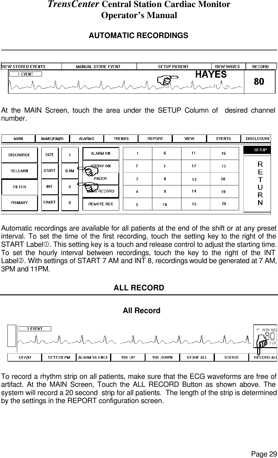 TrensCenter Central Station Cardiac Monitor Operator’s Manual Page 29  AUTOMATIC RECORDINGS                  At the MAIN Screen, touch the area under the SETUP Column of  desired channel number.   Automatic recordings are available for all patients at the end of the shift or at any preset interval. To set the time of the first recording, touch the setting key to the right of the START Label•. This setting key is a touch and release control to adjust the starting time. To set the hourly interval between recordings, touch the key to the right of the INT Label‚. With settings of START 7 AM and INT 8, recordings would be generated at 7 AM, 3PM and 11PM.   ALL RECORD     All Record    To record a rhythm strip on all patients, make sure that the ECG waveforms are free of artifact. At the MAIN Screen, Touch the ALL RECORD Button as shown above. The system will record a 20 second  strip for all patients.  The length of the strip is determined by the settings in the REPORT configuration screen. 