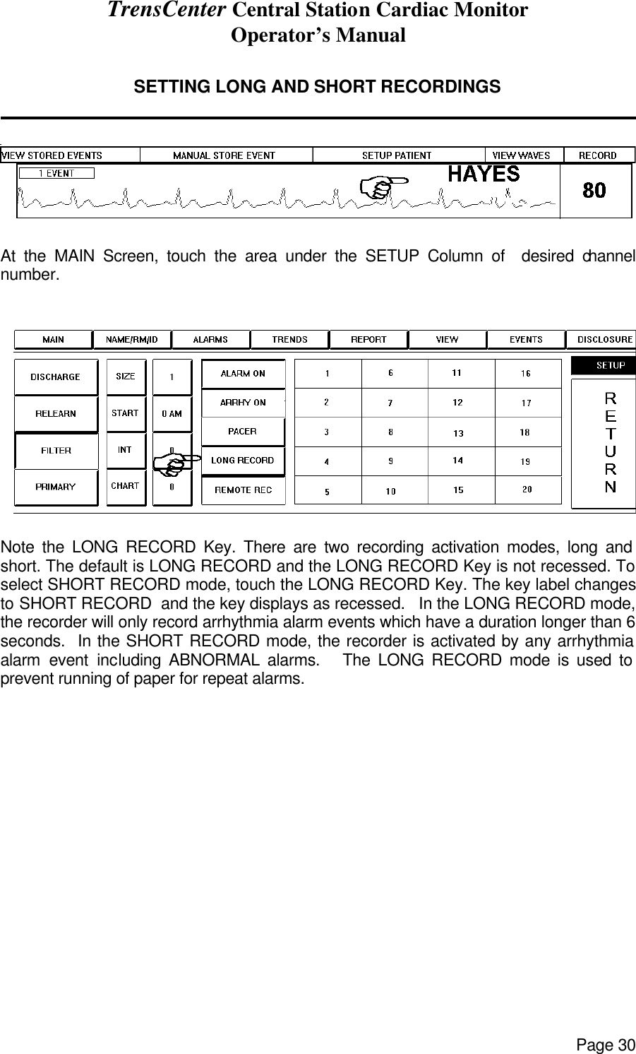 TrensCenter Central Station Cardiac Monitor Operator’s Manual Page 30  SETTING LONG AND SHORT RECORDINGS                  At the MAIN Screen, touch the area under the SETUP Column of  desired channel number.    Note the LONG RECORD Key. There are two recording activation modes, long and short. The default is LONG RECORD and the LONG RECORD Key is not recessed. To select SHORT RECORD mode, touch the LONG RECORD Key. The key label changes to SHORT RECORD  and the key displays as recessed.   In the LONG RECORD mode, the recorder will only record arrhythmia alarm events which have a duration longer than 6 seconds.  In the SHORT RECORD mode, the recorder is activated by any arrhythmia alarm event including ABNORMAL alarms.   The LONG RECORD mode is used to prevent running of paper for repeat alarms.  