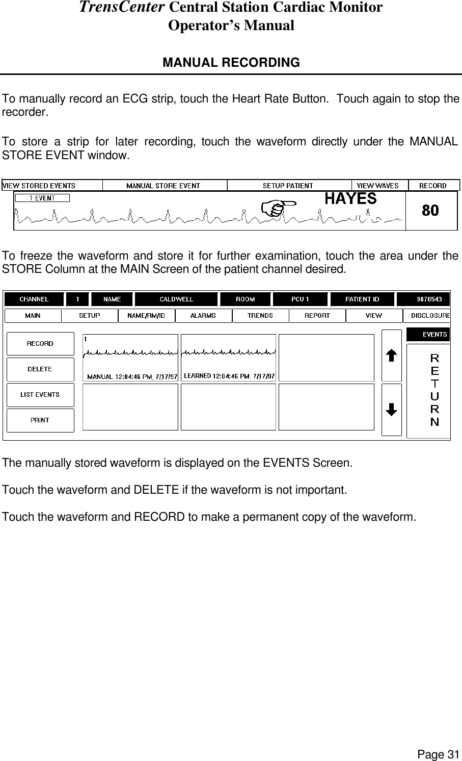 TrensCenter Central Station Cardiac Monitor Operator’s Manual Page 31  MANUAL RECORDING  To manually record an ECG strip, touch the Heart Rate Button.  Touch again to stop the recorder.   To store a strip for later recording, touch the waveform directly under the MANUAL STORE EVENT window.    To freeze the waveform and store it for further examination, touch the area under the STORE Column at the MAIN Screen of the patient channel desired.     The manually stored waveform is displayed on the EVENTS Screen.  Touch the waveform and DELETE if the waveform is not important.  Touch the waveform and RECORD to make a permanent copy of the waveform. 