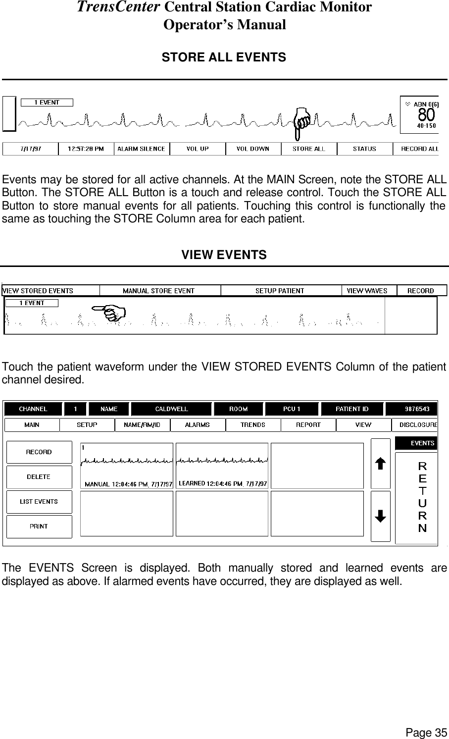 TrensCenter Central Station Cardiac Monitor Operator’s Manual Page 35  STORE ALL EVENTS                 Events may be stored for all active channels. At the MAIN Screen, note the STORE ALL Button. The STORE ALL Button is a touch and release control. Touch the STORE ALL Button to store manual events for all patients. Touching this control is functionally the same as touching the STORE Column area for each patient.  VIEW EVENTS    Touch the patient waveform under the VIEW STORED EVENTS Column of the patient channel desired.    The EVENTS Screen is displayed. Both manually stored and learned events are displayed as above. If alarmed events have occurred, they are displayed as well.  