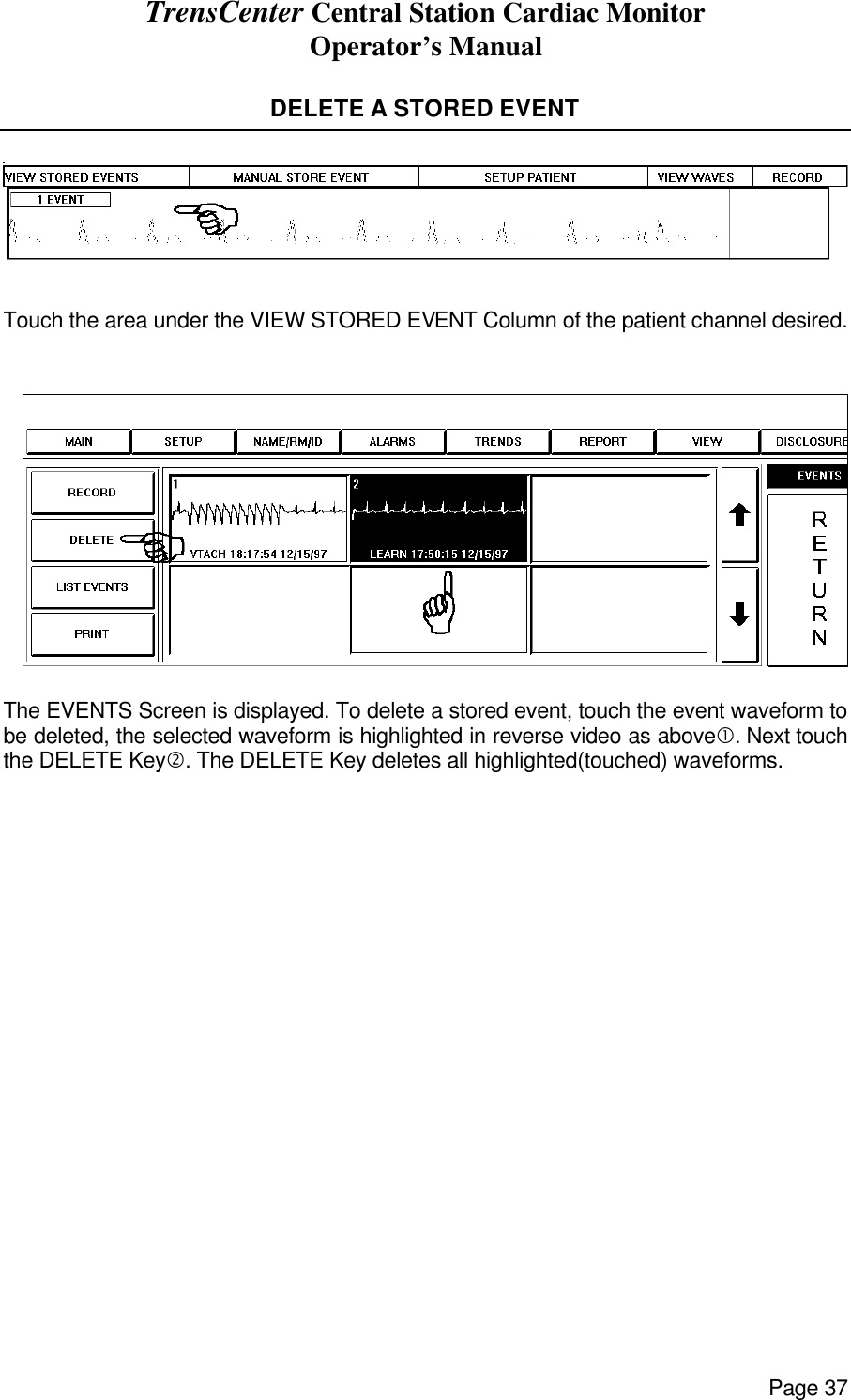 TrensCenter Central Station Cardiac Monitor Operator’s Manual Page 37  DELETE A STORED EVENT    Touch the area under the VIEW STORED EVENT Column of the patient channel desired.     The EVENTS Screen is displayed. To delete a stored event, touch the event waveform to be deleted, the selected waveform is highlighted in reverse video as above•. Next touch the DELETE Key‚. The DELETE Key deletes all highlighted(touched) waveforms.             