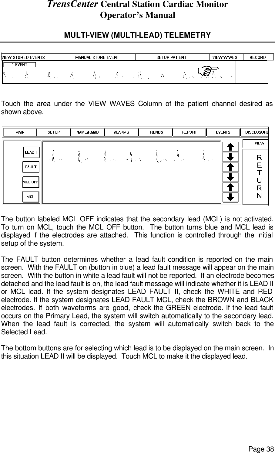 TrensCenter Central Station Cardiac Monitor Operator’s Manual Page 38  MULTI-VIEW (MULTI-LEAD) TELEMETRY   Touch the area under the VIEW WAVES Column of the patient channel desired as shown above.   The button labeled MCL OFF indicates that the secondary lead (MCL) is not activated.  To turn on MCL, touch the MCL OFF button.  The button turns blue and MCL lead is displayed if the electrodes are attached.  This function is controlled through the initial setup of the system.  The FAULT button determines whether a lead fault condition is reported on the main screen.  With the FAULT on (button in blue) a lead fault message will appear on the main screen.  With the button in white a lead fault will not be reported.  If an electrode becomes detached and the lead fault is on, the lead fault message will indicate whether it is LEAD II or MCL lead. If the system designates LEAD FAULT II, check the WHITE and RED electrode. If the system designates LEAD FAULT MCL, check the BROWN and BLACK electrodes. If both waveforms are good, check the GREEN electrode. If the lead fault occurs on the Primary Lead, the system will switch automatically to the secondary lead. When the lead fault is corrected, the system will automatically switch back to the Selected Lead.  The bottom buttons are for selecting which lead is to be displayed on the main screen.  In this situation LEAD II will be displayed.  Touch MCL to make it the displayed lead.     