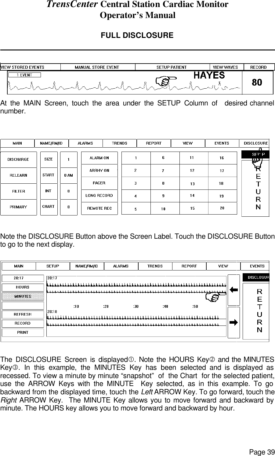 TrensCenter Central Station Cardiac Monitor Operator’s Manual Page 39  FULL DISCLOSURE                At the MAIN Screen, touch the area under the SETUP Column of  desired channel number.    Note the DISCLOSURE Button above the Screen Label. Touch the DISCLOSURE Button to go to the next display.   The DISCLOSURE Screen is displayed•. Note the HOURS Key‚ and the MINUTES Keyƒ. In this example, the MINUTES Key has been selected and is displayed as recessed. To view a minute by minute “snapshot”  of  the Chart  for the selected patient, use the ARROW Keys with the MINUTE  Key selected, as in this example. To go backward from the displayed time, touch the Left ARROW Key. To go forward, touch the Right ARROW Key.  The MINUTE Key allows you to move forward and backward by minute. The HOURS key allows you to move forward and backward by hour. 