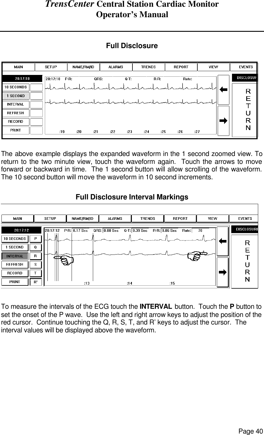 TrensCenter Central Station Cardiac Monitor Operator’s Manual Page 40   Full Disclosure   The above example displays the expanded waveform in the 1 second zoomed view. To return to the two minute view, touch the waveform again.  Touch the arrows to move forward or backward in time.  The 1 second button will allow scrolling of the waveform.  The 10 second button will move the waveform in 10 second increments.  Full Disclosure Interval Markings   To measure the intervals of the ECG touch the INTERVAL button.  Touch the P button to set the onset of the P wave.  Use the left and right arrow keys to adjust the position of the red cursor.  Continue touching the Q, R, S, T, and R’ keys to adjust the cursor.  The interval values will be displayed above the waveform.       