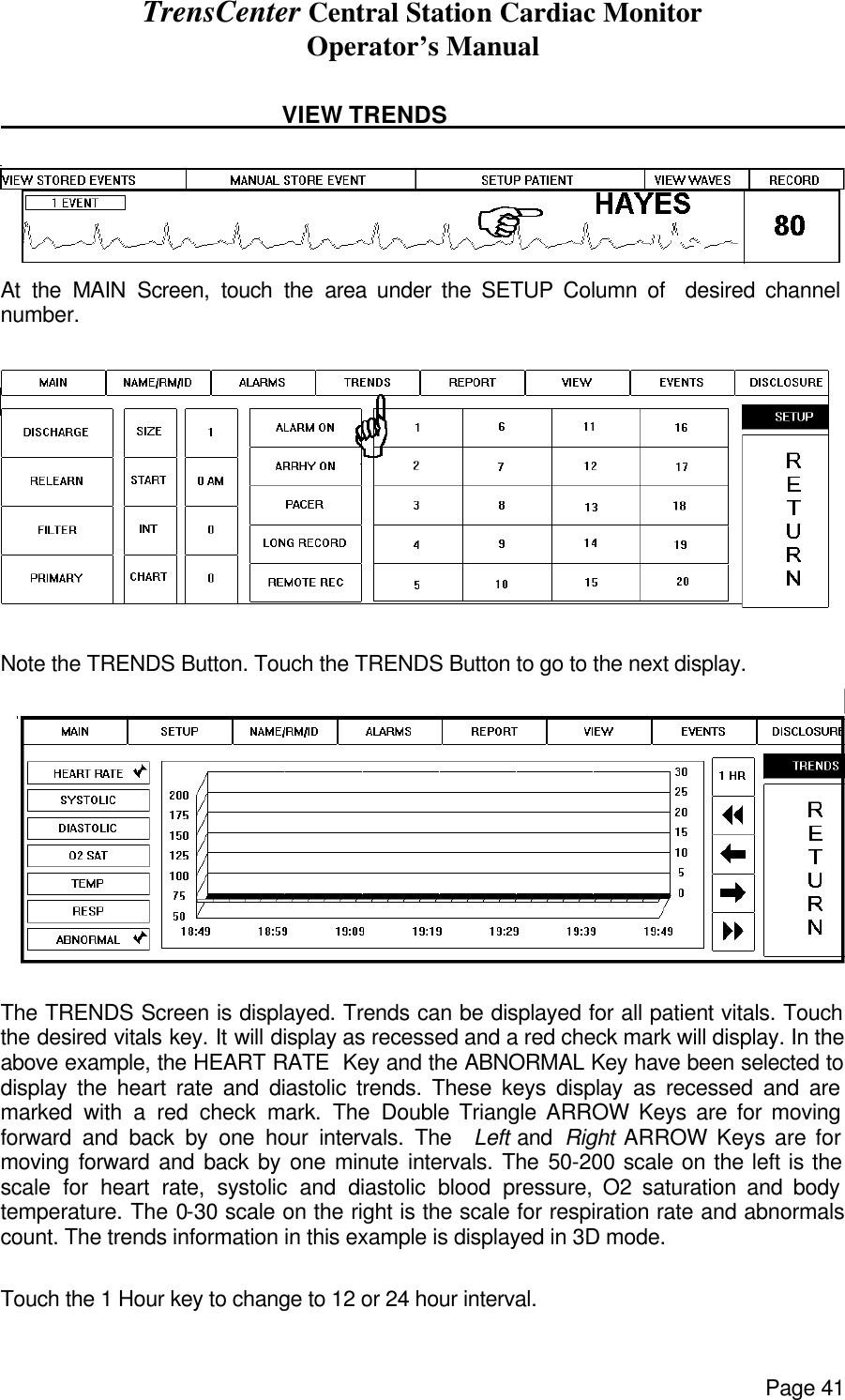 TrensCenter Central Station Cardiac Monitor Operator’s Manual Page 41                                                  VIEW TRENDS         At the MAIN Screen, touch the area under the SETUP Column of  desired channel number.   Note the TRENDS Button. Touch the TRENDS Button to go to the next display.   The TRENDS Screen is displayed. Trends can be displayed for all patient vitals. Touch the desired vitals key. It will display as recessed and a red check mark will display. In the above example, the HEART RATE  Key and the ABNORMAL Key have been selected to display the heart rate and diastolic trends. These keys display as recessed and are marked with a red check mark. The Double Triangle ARROW Keys are for moving forward and back by one hour intervals. The  Left and  Right ARROW Keys are for moving forward and back by one minute intervals. The 50-200 scale on the left is the scale for heart rate, systolic and diastolic blood pressure, O2 saturation and body temperature. The 0-30 scale on the right is the scale for respiration rate and abnormals count. The trends information in this example is displayed in 3D mode.    Touch the 1 Hour key to change to 12 or 24 hour interval. 