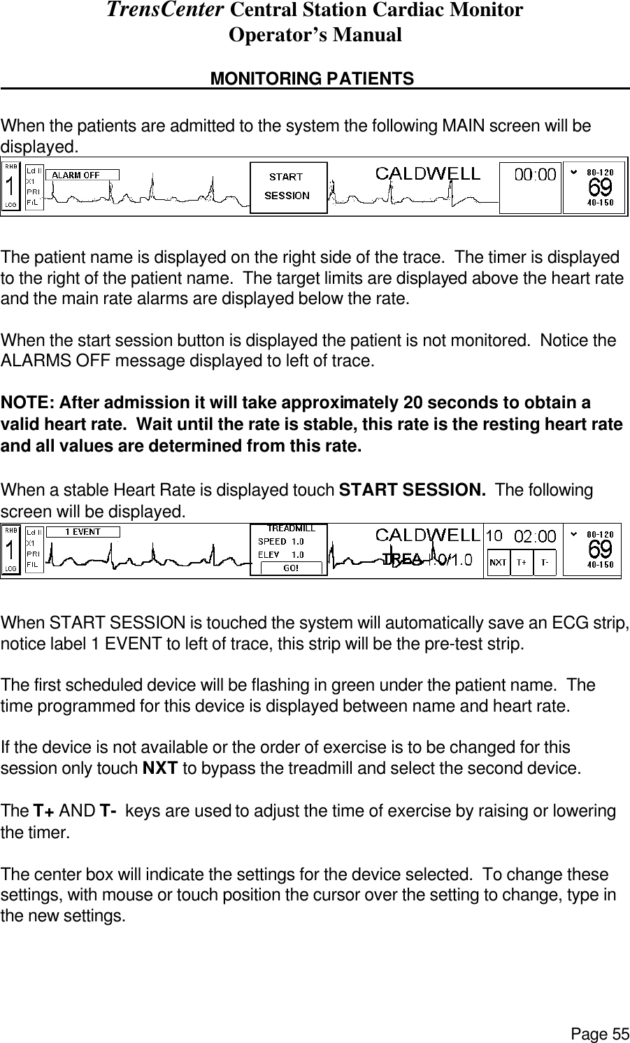 TrensCenter Central Station Cardiac Monitor Operator’s Manual Page 55      MONITORING PATIENTS       When the patients are admitted to the system the following MAIN screen will be displayed.  The patient name is displayed on the right side of the trace.  The timer is displayed to the right of the patient name.  The target limits are displayed above the heart rate and the main rate alarms are displayed below the rate.  When the start session button is displayed the patient is not monitored.  Notice the ALARMS OFF message displayed to left of trace.   NOTE: After admission it will take approximately 20 seconds to obtain a valid heart rate.  Wait until the rate is stable, this rate is the resting heart rate and all values are determined from this rate.  When a stable Heart Rate is displayed touch START SESSION.  The following screen will be displayed. When START SESSION is touched the system will automatically save an ECG strip, notice label 1 EVENT to left of trace, this strip will be the pre-test strip.  The first scheduled device will be flashing in green under the patient name.  The time programmed for this device is displayed between name and heart rate.  If the device is not available or the order of exercise is to be changed for this session only touch NXT to bypass the treadmill and select the second device.  The T+ AND T-  keys are used to adjust the time of exercise by raising or lowering the timer.    The center box will indicate the settings for the device selected.  To change these settings, with mouse or touch position the cursor over the setting to change, type in the new settings.  