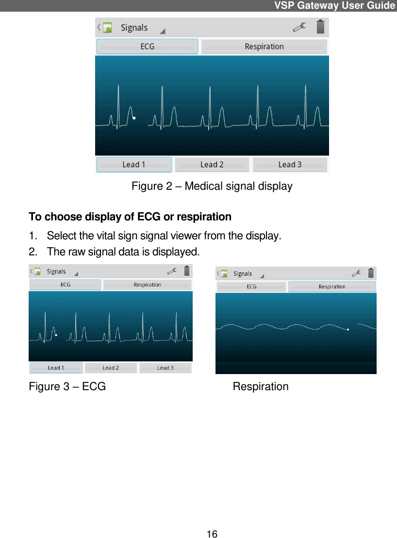 VSP Gateway User Guide 16  Figure 2 – Medical signal display To choose display of ECG or respiration 1.  Select the vital sign signal viewer from the display.  2.  The raw signal data is displayed.           Figure 3 – ECG                                         Respiration     
