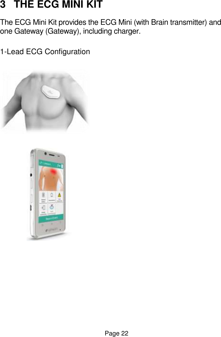  Page 22 3  THE ECG MINI KIT The ECG Mini Kit provides the ECG Mini (with Brain transmitter) and one Gateway (Gateway), including charger.   1-Lead ECG Configuration               