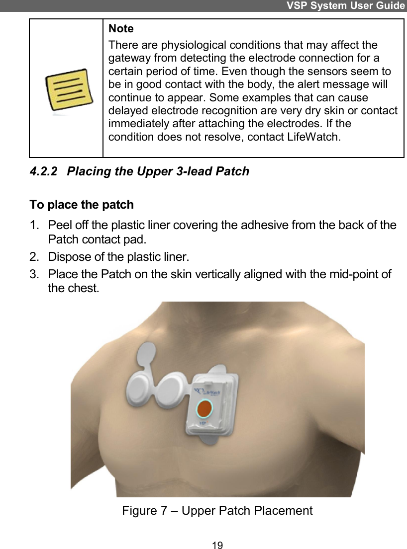VSP System User Guide19 Note There are physiological conditions that may affect the gateway from detecting the electrode connection certain period of time. Even though the sensorbe in good contact with the body, the alert continue to appear. Some examples that can cause delayed electrode recognition are very dry skin or immediately after attaching the electrodes. If the condition does not resolve, contact LifeWatch.4.2.2  Placing the Upper 3-lead Patch To place the patch 1. Peel off the plastic liner covering the adhesive from the back of the Patch contact pad. 2.  Dispose of the plastic liner. 3.  Place the Patch on the skin vertically aligned with the the chest. Figure 7 – Upper Patch Placement VSP System User Guide There are physiological conditions that may affect the gateway from detecting the electrode connection for a sensors seem to alert message will that can cause are very dry skin or contact after attaching the electrodes. If the condition does not resolve, contact LifeWatch. Peel off the plastic liner covering the adhesive from the back of the with the mid-point of   