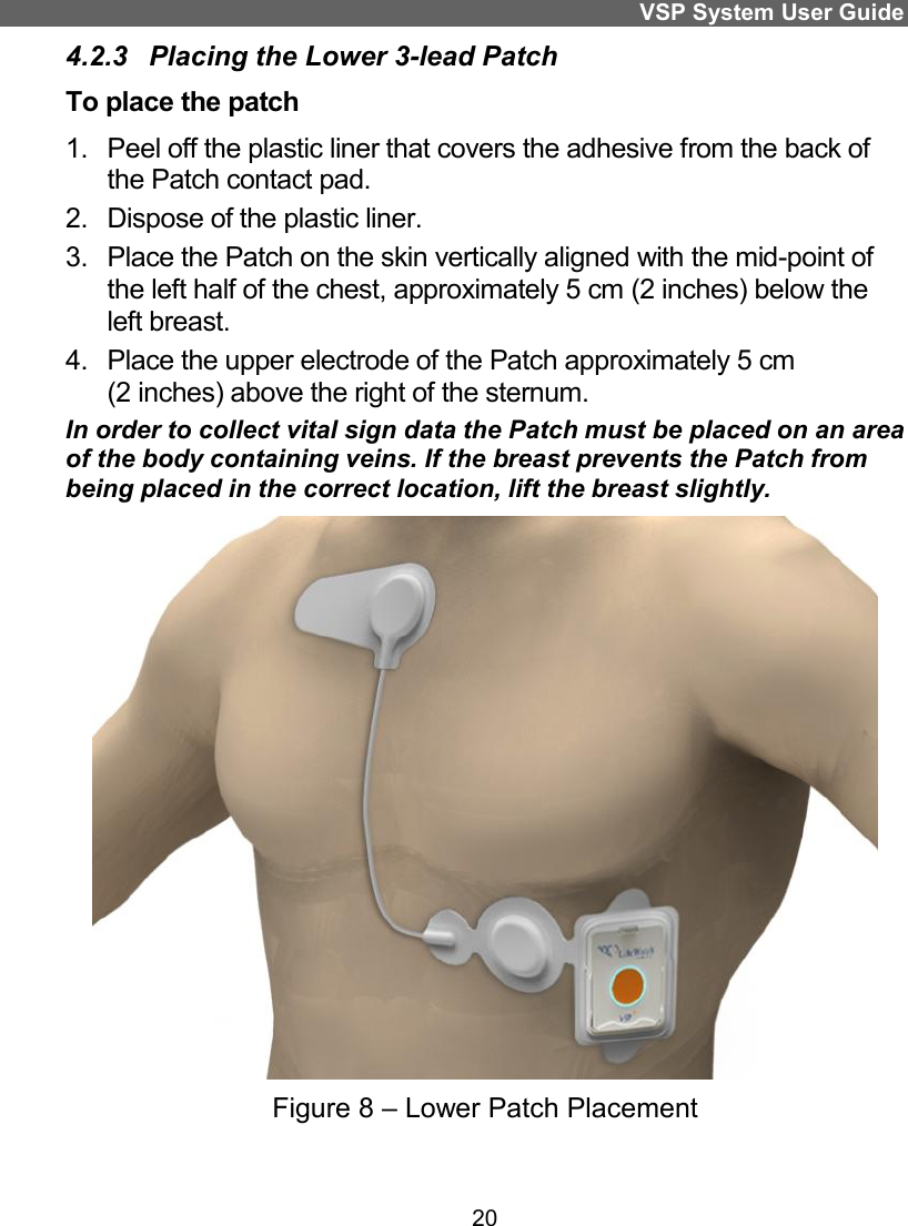VSP System User Guide 20 4.2.3  Placing the Lower 3-lead Patch To place the patch 1.  Peel off the plastic liner that covers the adhesive from the back of the Patch contact pad. 2.  Dispose of the plastic liner. 3.  Place the Patch on the skin vertically aligned with the mid-point of the left half of the chest, approximately 5 cm (2 inches) below the left breast.  4.  Place the upper electrode of the Patch approximately 5 cm  (2 inches) above the right of the sternum.  In order to collect vital sign data the Patch must be placed on an area of the body containing veins. If the breast prevents the Patch from being placed in the correct location, lift the breast slightly.  Figure 8 – Lower Patch Placement 