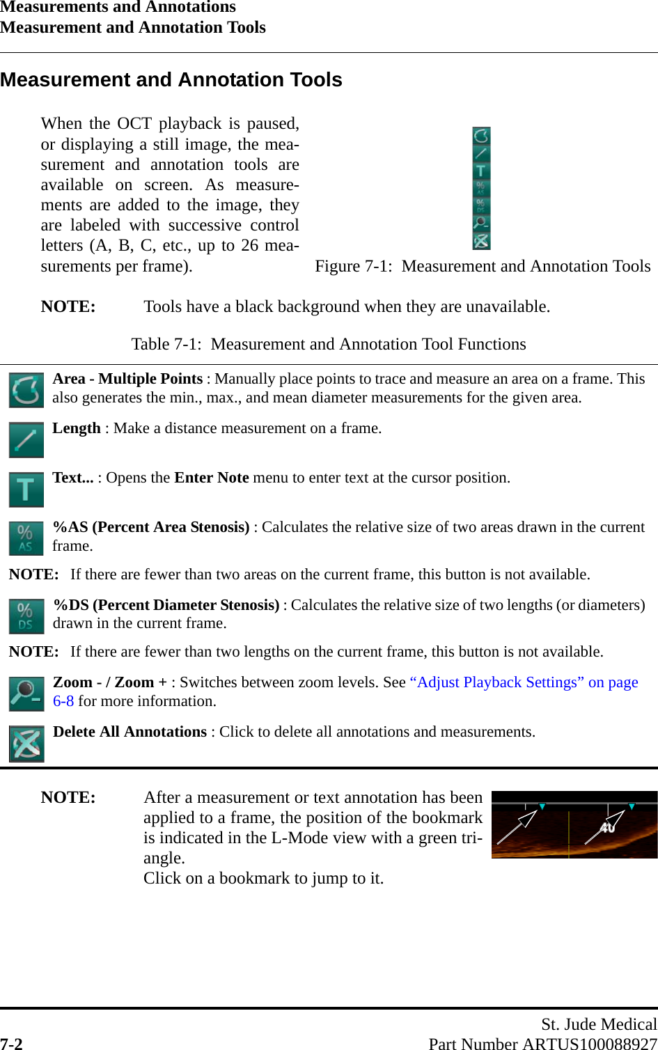 Measurements and AnnotationsMeasurement and Annotation ToolsSt. Jude Medical7-2 Part Number ARTUS100088927Measurement and Annotation ToolsWhen the OCT playback is paused,or displaying a still image, the mea-surement and annotation tools areavailable on screen. As measure-ments are added to the image, theyare labeled with successive controlletters (A, B, C, etc., up to 26 mea-surements per frame).NOTE: Tools have a black background when they are unavailable.NOTE: After a measurement or text annotation has beenapplied to a frame, the position of the bookmarkis indicated in the L-Mode view with a green tri-angle.Click on a bookmark to jump to it.Table 7-1:  Measurement and Annotation Tool FunctionsArea - Multiple Points : Manually place points to trace and measure an area on a frame. This also generates the min., max., and mean diameter measurements for the given area.Length : Make a distance measurement on a frame.Text... : Opens the Enter Note menu to enter text at the cursor position.%AS (Percent Area Stenosis) : Calculates the relative size of two areas drawn in the current frame.NOTE: If there are fewer than two areas on the current frame, this button is not available.%DS (Percent Diameter Stenosis) : Calculates the relative size of two lengths (or diameters) drawn in the current frame.NOTE: If there are fewer than two lengths on the current frame, this button is not available.Zoom - / Zoom + : Switches between zoom levels. See “Adjust Playback Settings” on page 6-8 for more information.Delete All Annotations : Click to delete all annotations and measurements.Figure 7-1:  Measurement and Annotation Tools