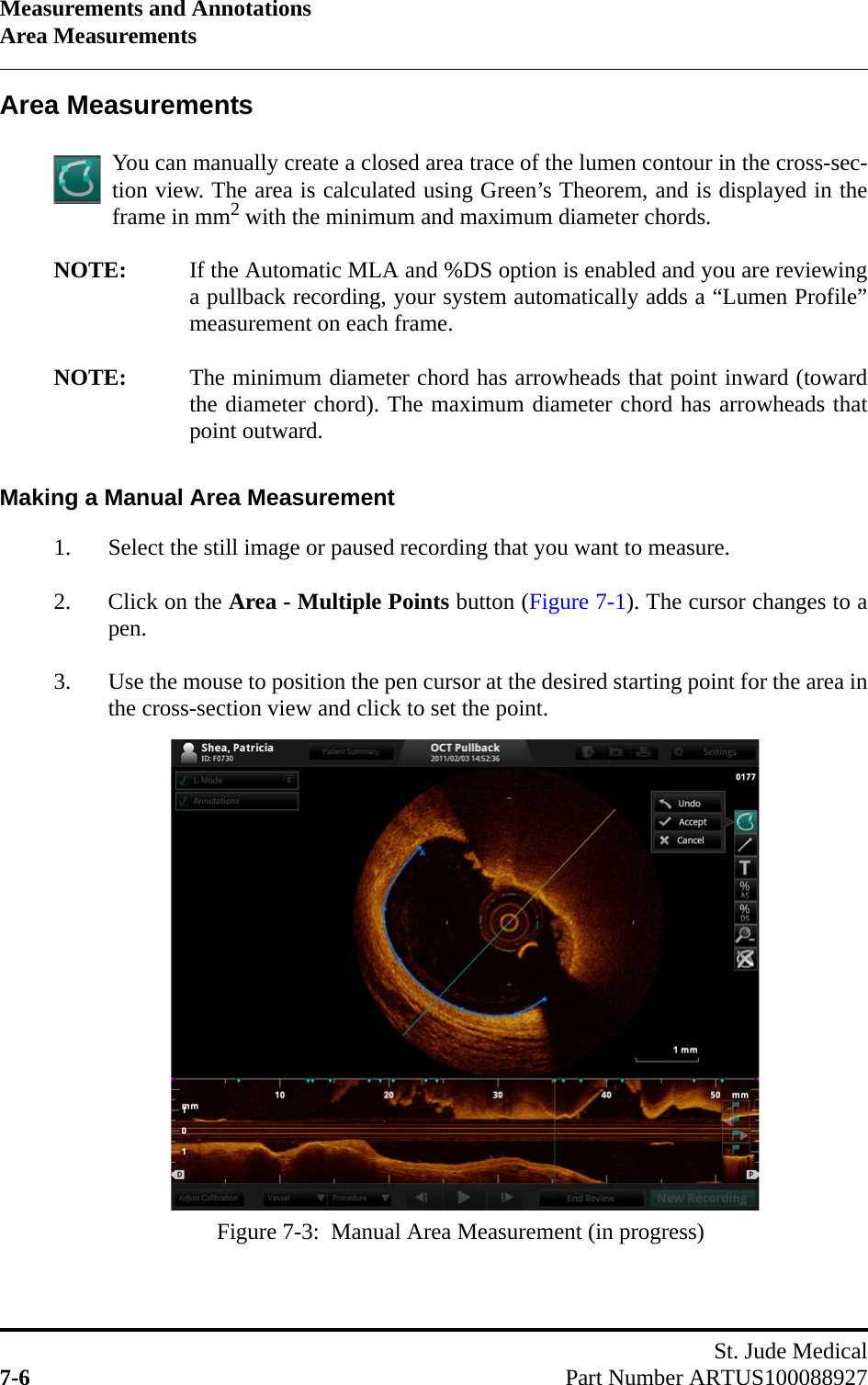 Measurements and AnnotationsArea MeasurementsSt. Jude Medical7-6 Part Number ARTUS100088927Area MeasurementsYou can manually create a closed area trace of the lumen contour in the cross-sec-tion view. The area is calculated using Green’s Theorem, and is displayed in theframe in mm2 with the minimum and maximum diameter chords.NOTE: If the Automatic MLA and %DS option is enabled and you are reviewinga pullback recording, your system automatically adds a “Lumen Profile”measurement on each frame.NOTE: The minimum diameter chord has arrowheads that point inward (towardthe diameter chord). The maximum diameter chord has arrowheads thatpoint outward.Making a Manual Area Measurement1. Select the still image or paused recording that you want to measure.2. Click on the Area - Multiple Points button (Figure 7-1). The cursor changes to apen.3. Use the mouse to position the pen cursor at the desired starting point for the area inthe cross-section view and click to set the point.Figure 7-3:  Manual Area Measurement (in progress)