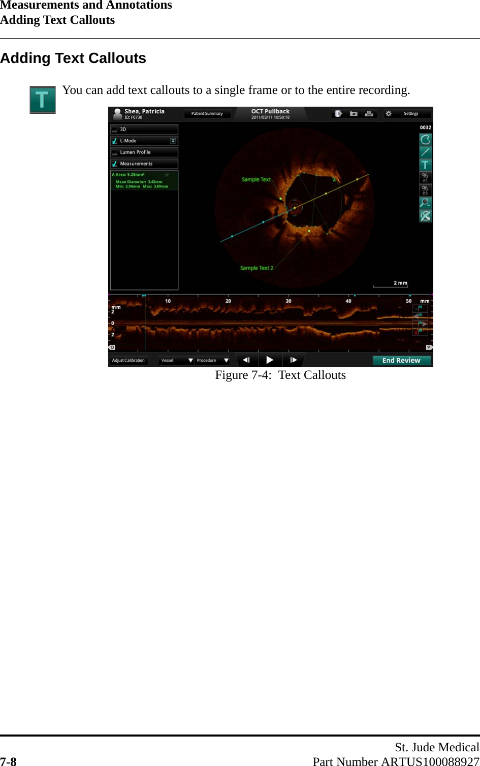 Measurements and AnnotationsAdding Text CalloutsSt. Jude Medical7-8 Part Number ARTUS100088927Adding Text CalloutsYou can add text callouts to a single frame or to the entire recording.Figure 7-4:  Text Callouts