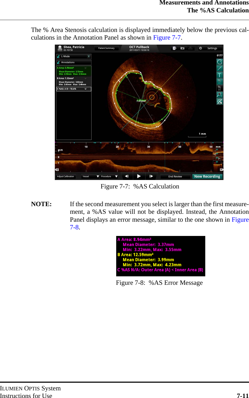 Measurements and AnnotationsThe %AS CalculationILUMIEN OPTIS SystemInstructions for Use 7-11The % Area Stenosis calculation is displayed immediately below the previous cal-culations in the Annotation Panel as shown in Figure 7-7.NOTE: If the second measurement you select is larger than the first measure-ment, a %AS value will not be displayed. Instead, the AnnotationPanel displays an error message, similar to the one shown in Figure7-8.Figure 7-7:  %AS CalculationFigure 7-8:  %AS Error Message